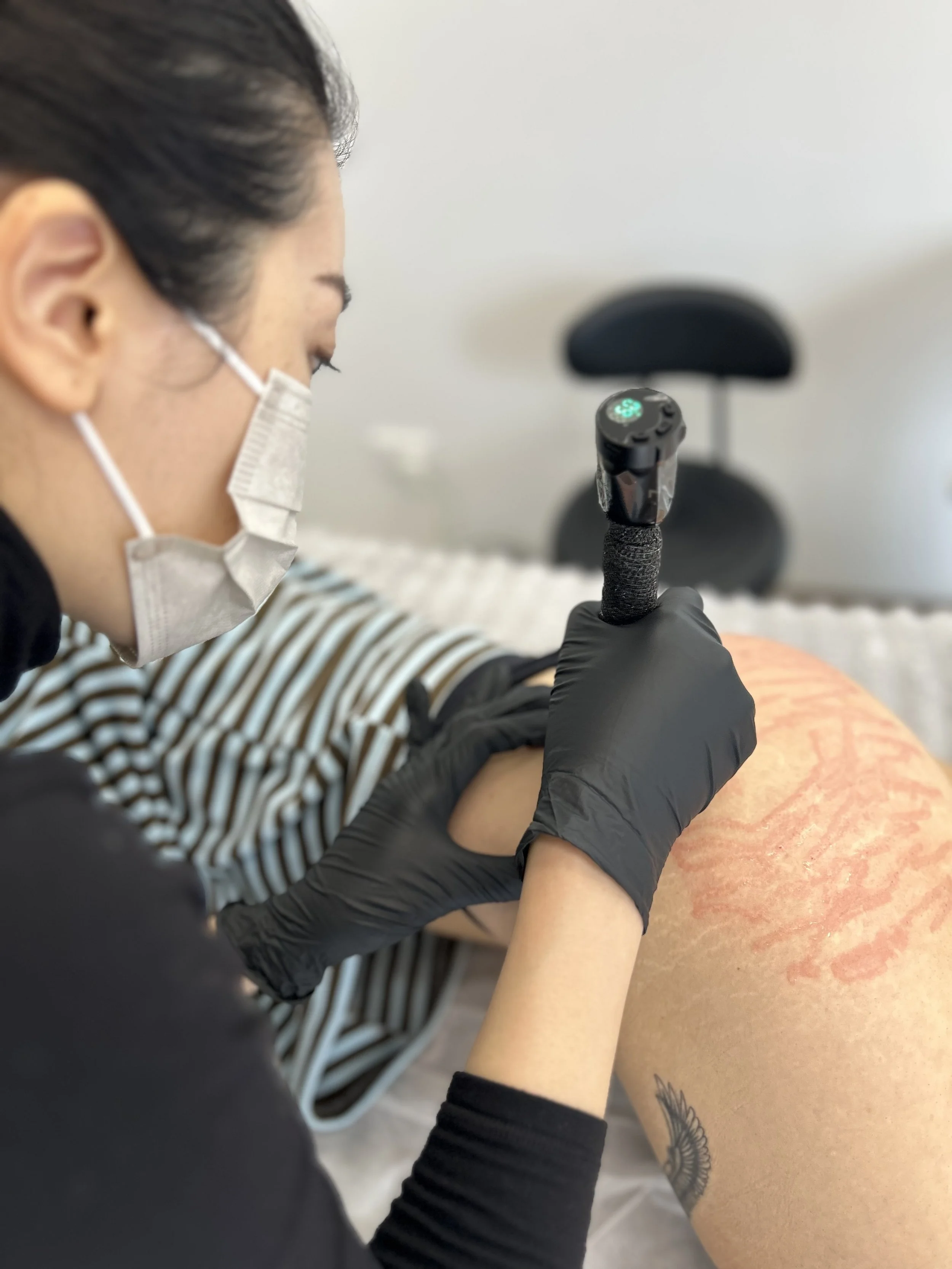 A person wearing a face mask and black gloves tattooing serum to fix stretchmarks on a patient's lower body.
