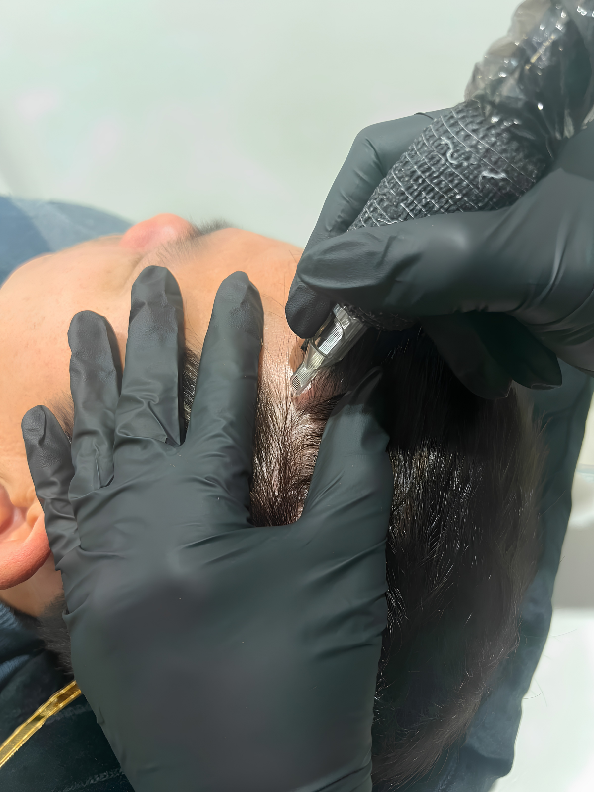 A person receiving a tattoo on the scalp from a tattoo artist wearing black gloves.