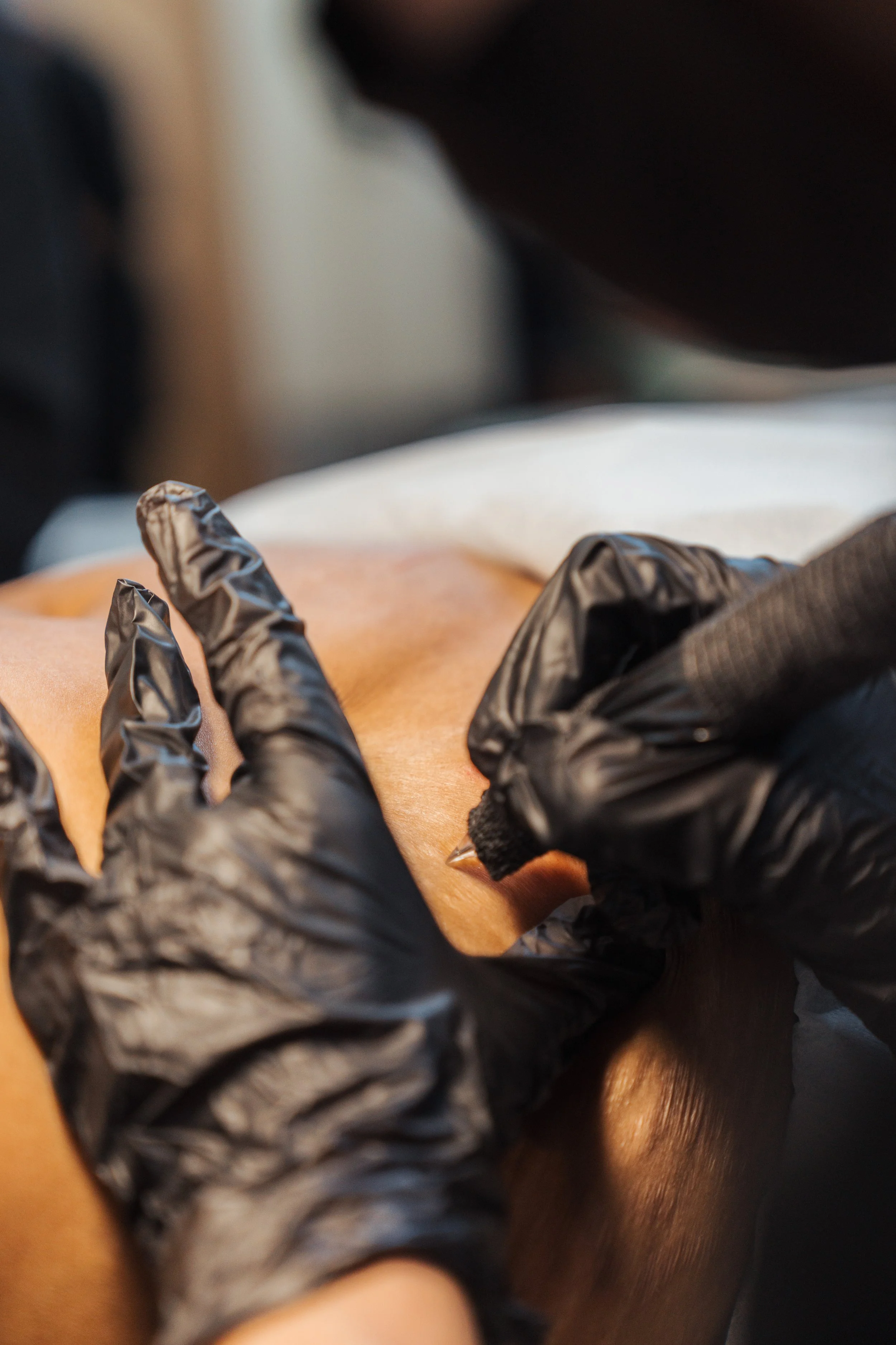 Close-up of a person with black gloves performing a procedure on skin, with medical or skincare tools visible.
