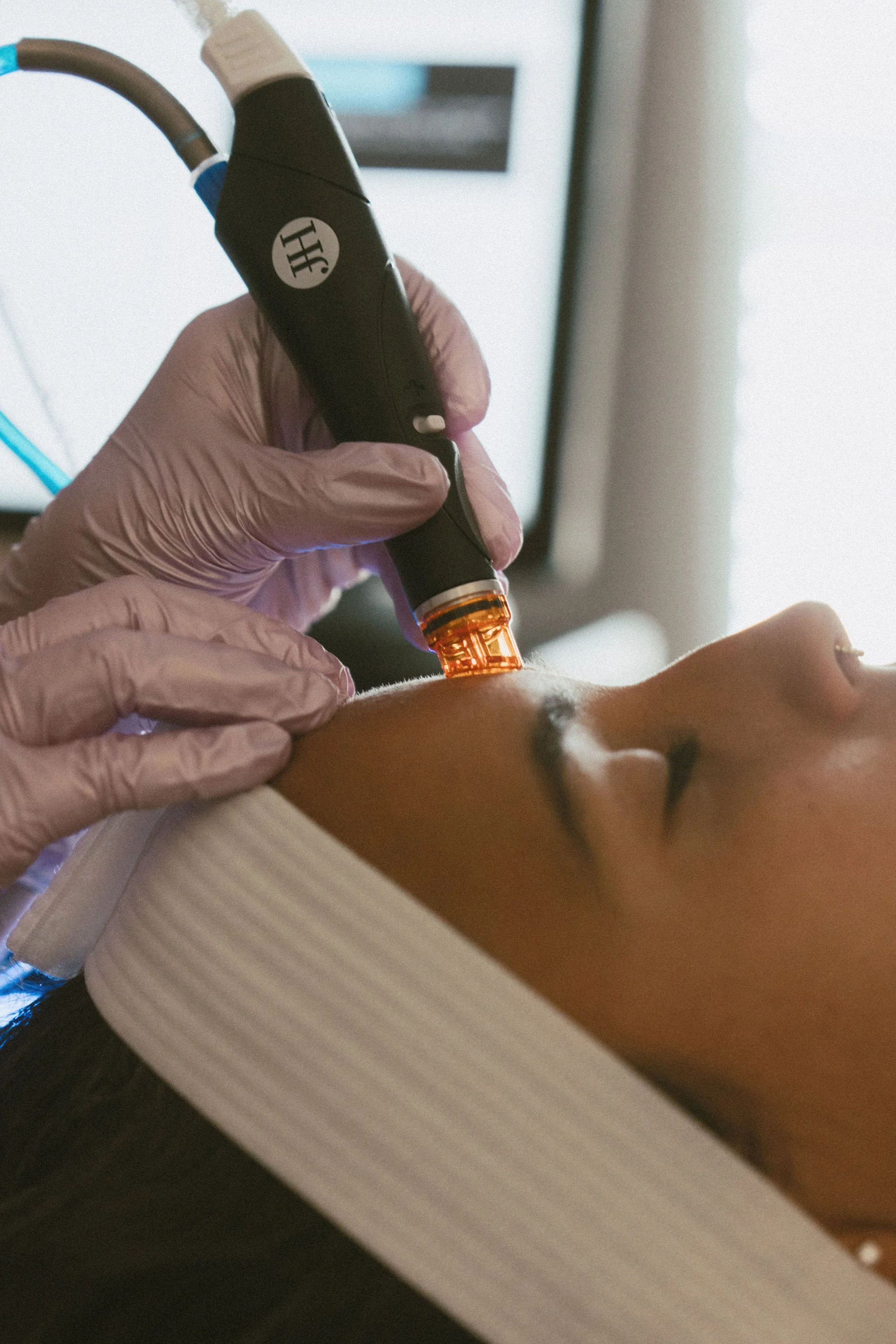 A medical professional wearing gloves is performing a procedure on a patient's face, using a Hydrafacial device near the forehead area, in a spa setting.