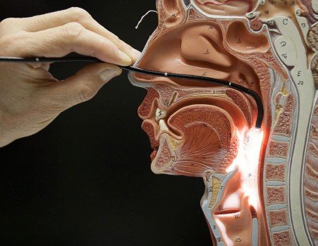 A detailed anatomical diagram of a human head showing the inside of the nasal cavity and throat with a medical instrument inserted to display the area.
