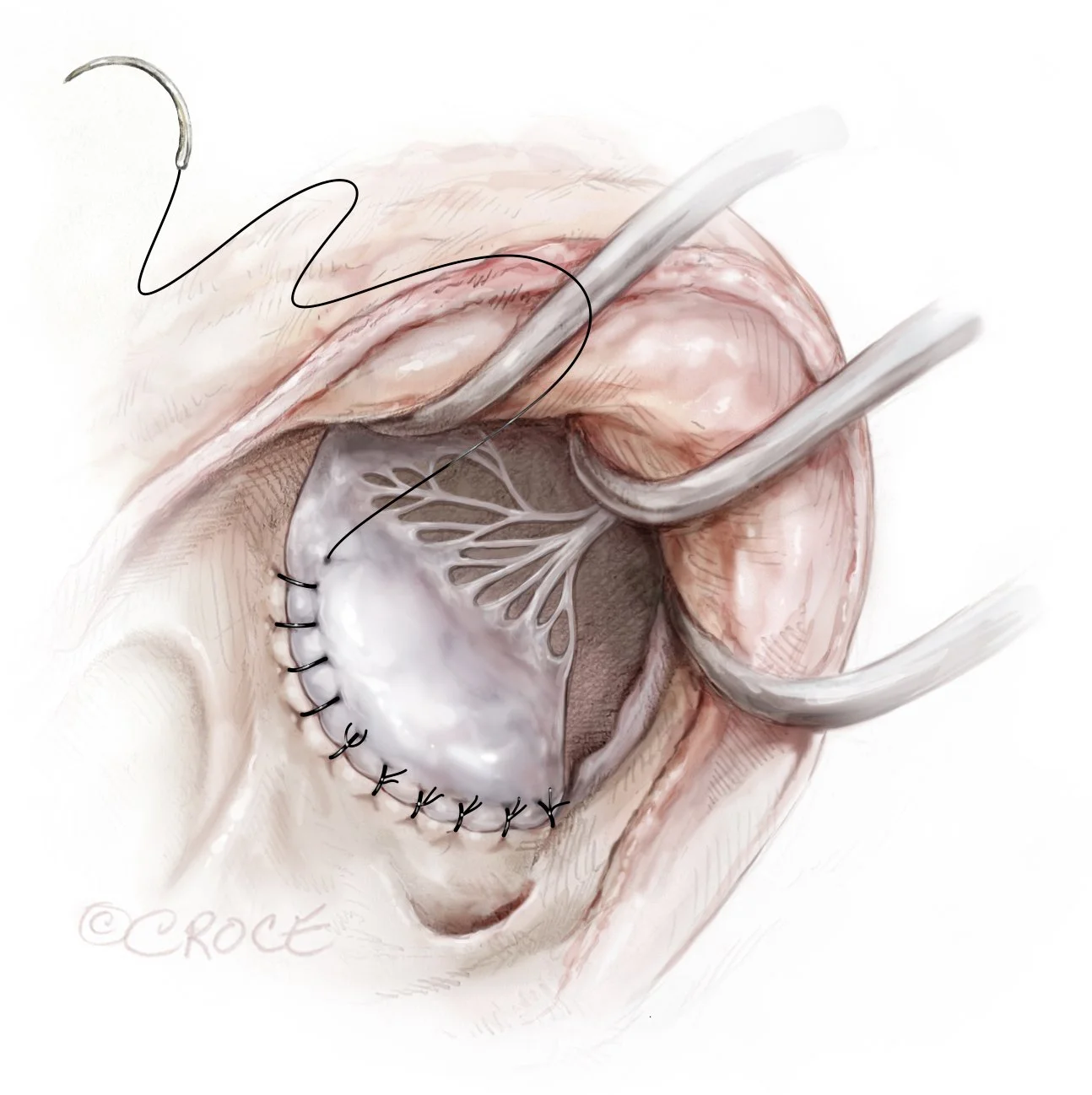 RAZATricuspidColour01.jpg