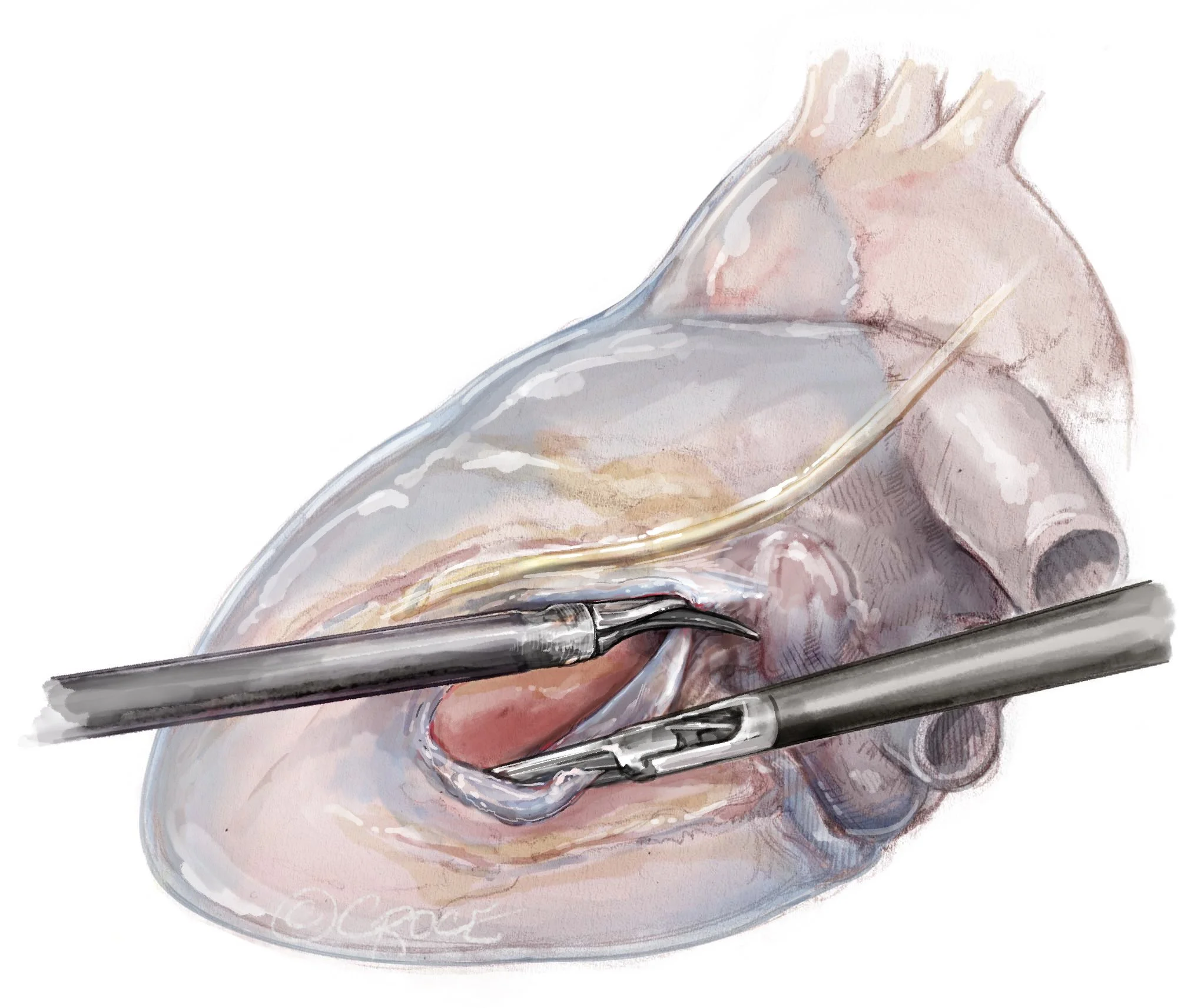 Atr1210fig02.jpg
