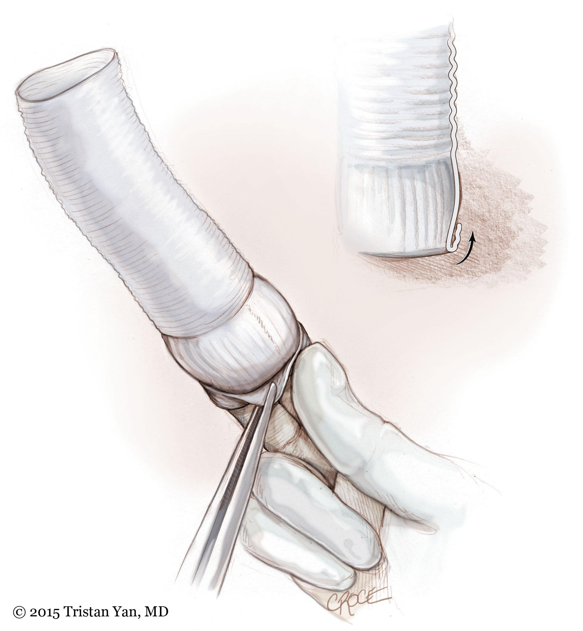 FrenchCuff02.jpg