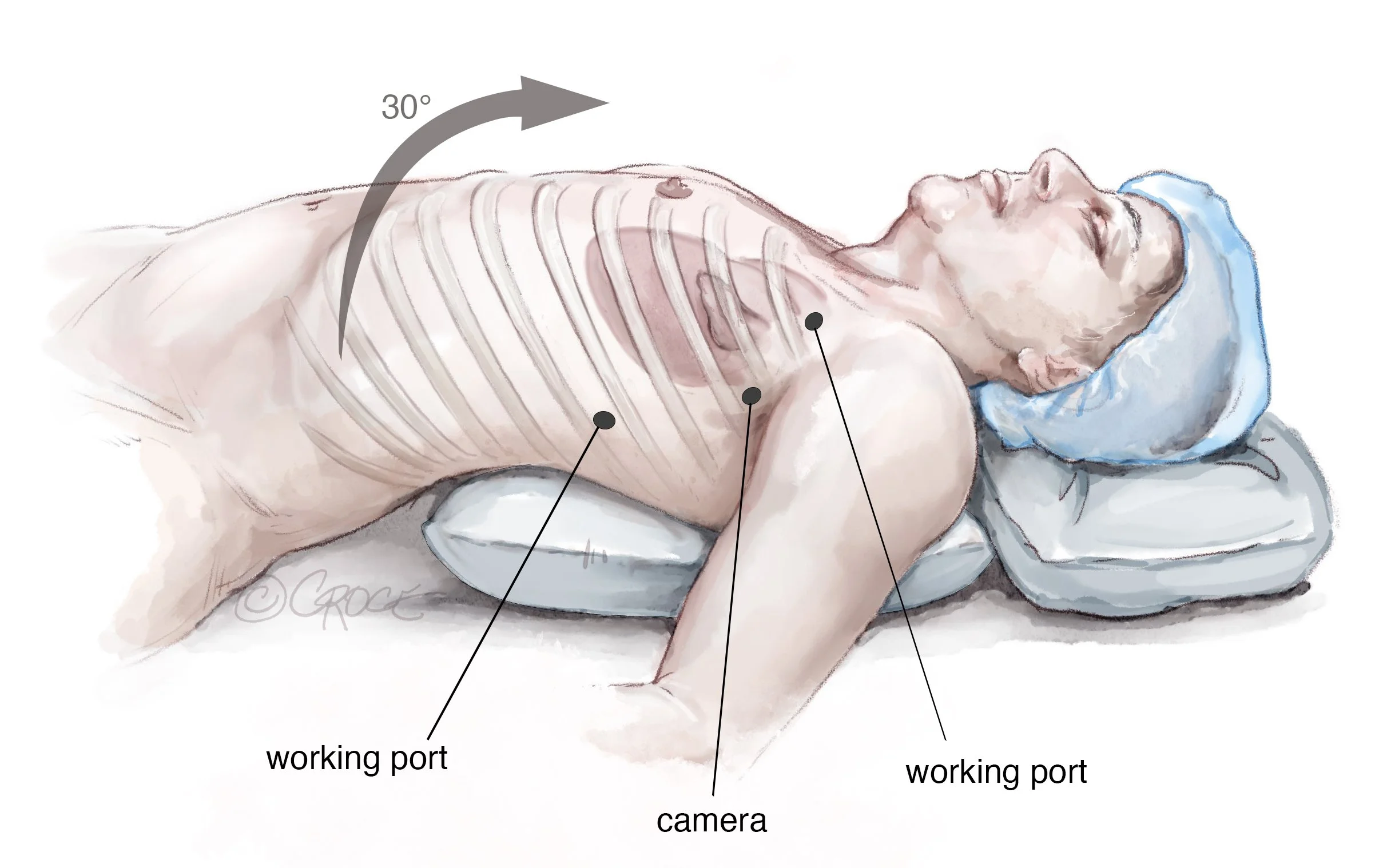 Atr1210Fig01.jpg