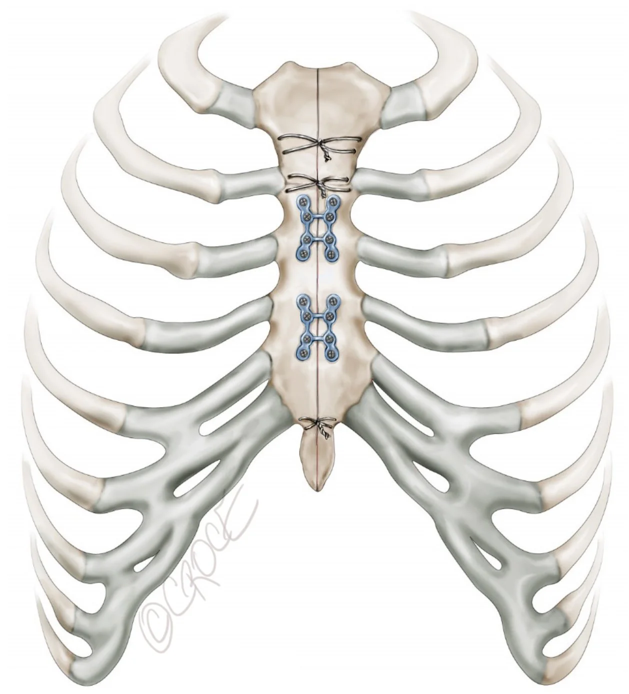 Raman1808fig04.jpg