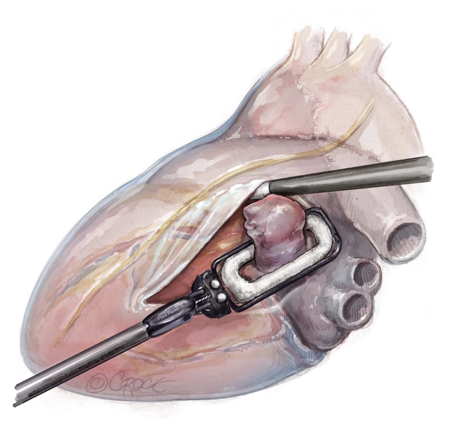 Atr1210fig04.jpg