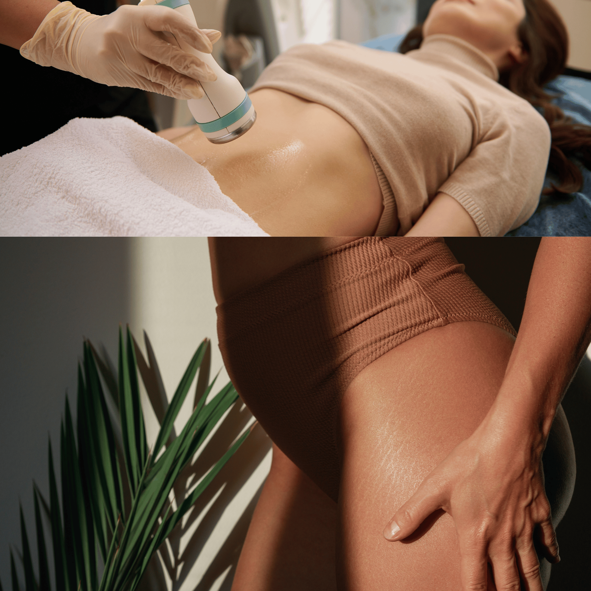 A woman lying down on her side, receiving a body treatment with a handheld device on her stomach, while her other hand rests on her hip. She is wearing a beige top and brown textured shorts. A potted plant with long green leaves is visible in the foreground.