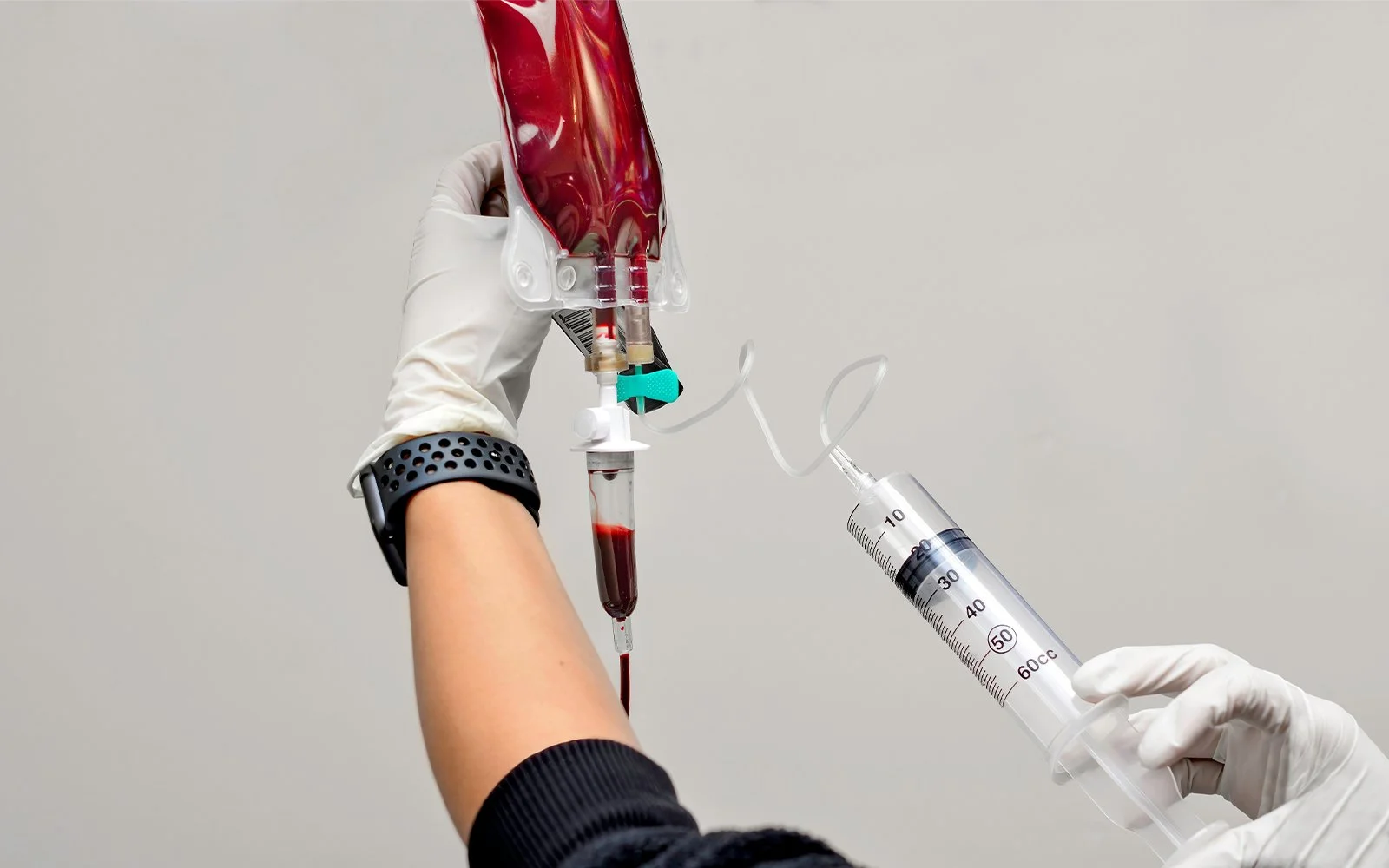 IV Ozone Therapy