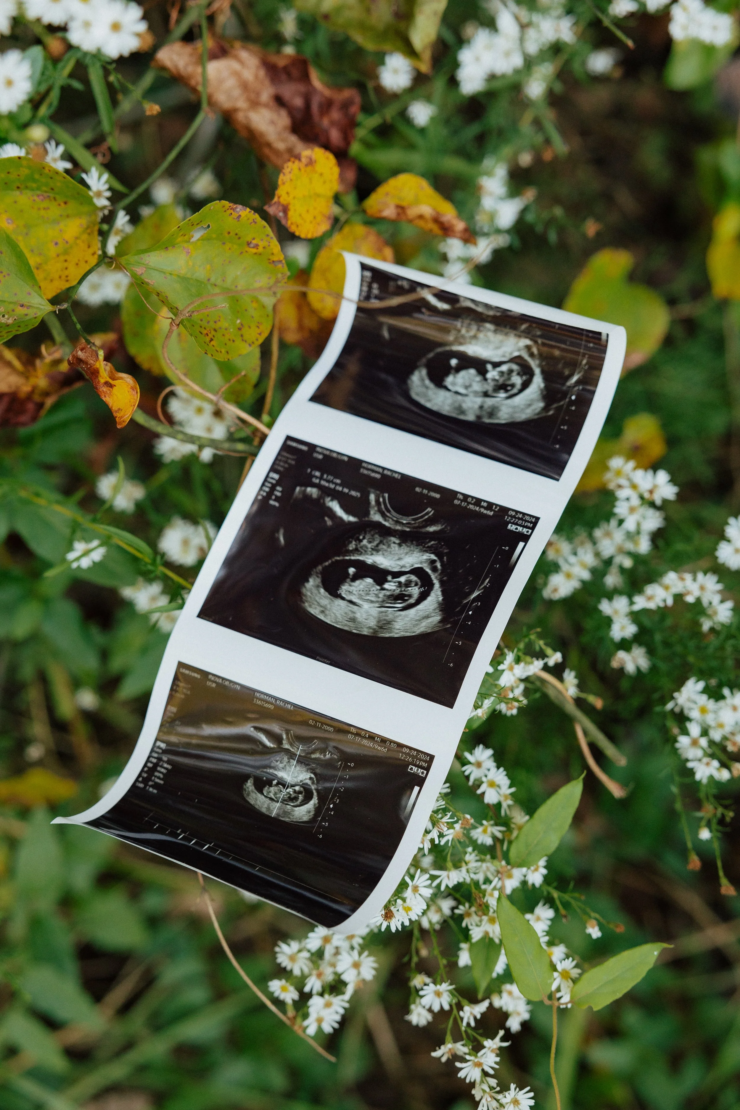 A black-and-white ultrasound image tape lying among green leaves and small white flowers in an outdoor setting.