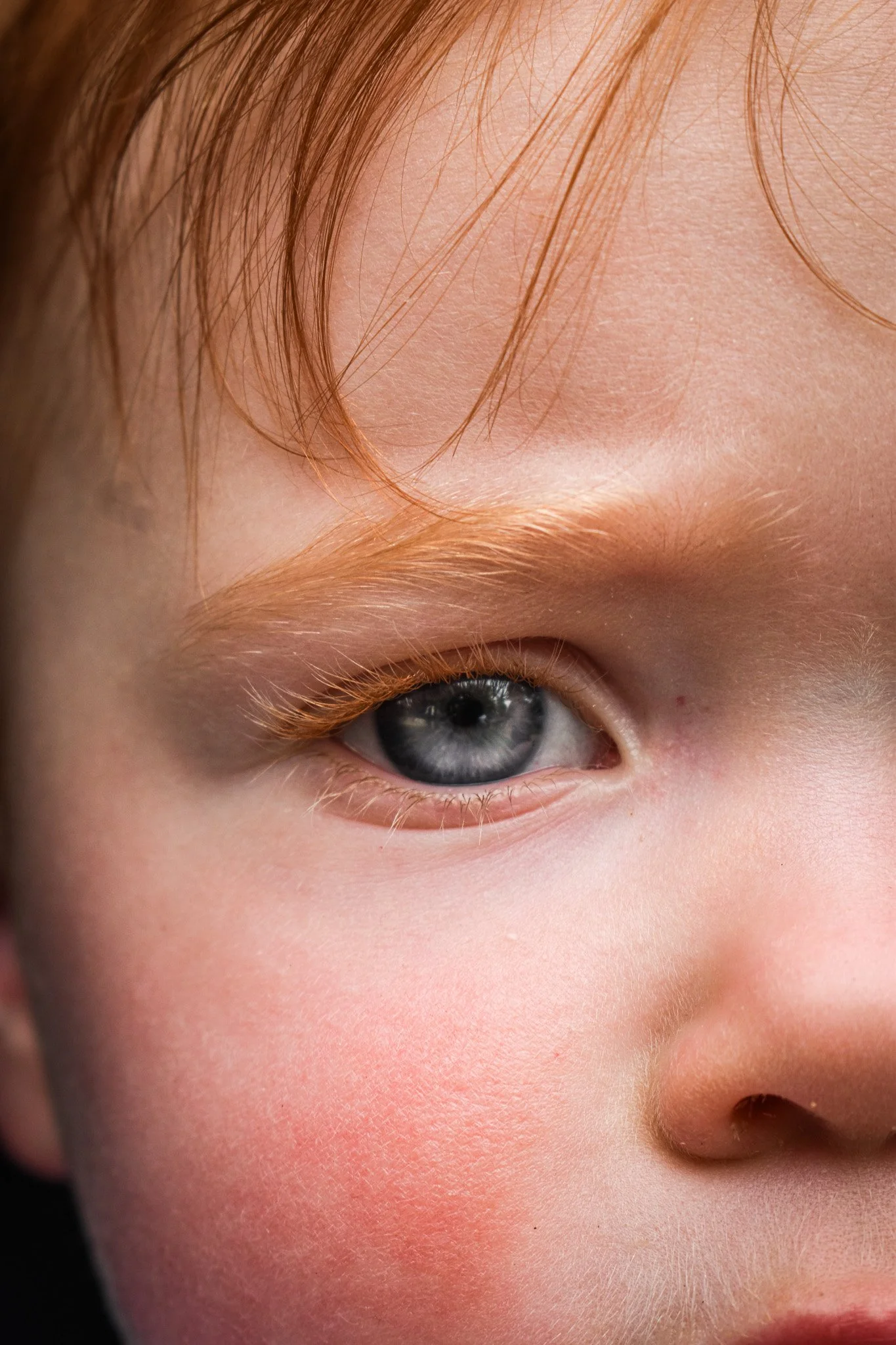 Close-up of a person's face, focusing on their eye, eyelid, and surrounding skin with reddish-brown hair visible.