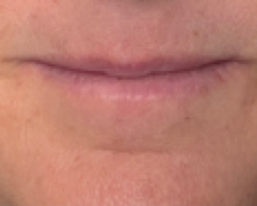 Before