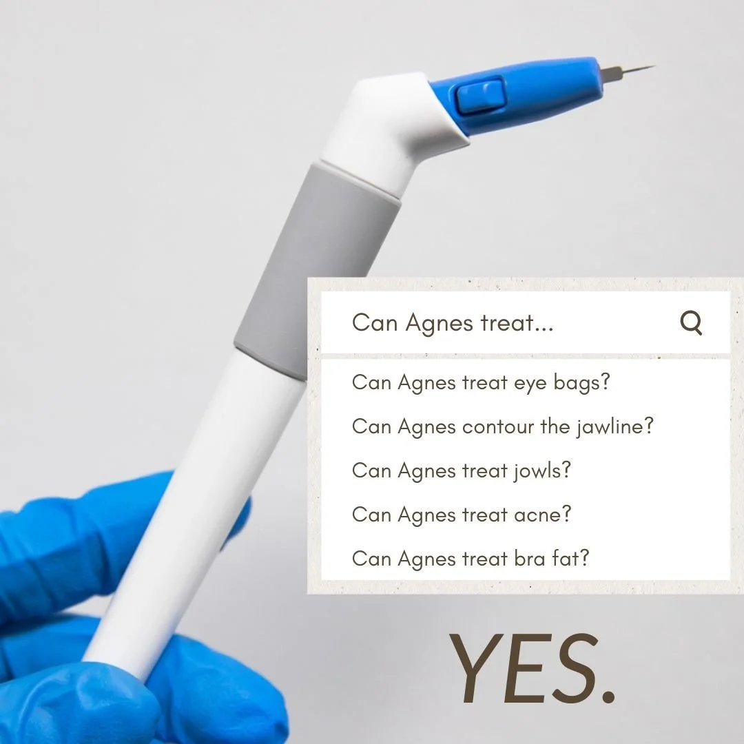 A person wearing blue gloves holding a medical device with a digital screen. The screen shows a search bar and questions related to skincare treatments, with the phrase "YES." written below.