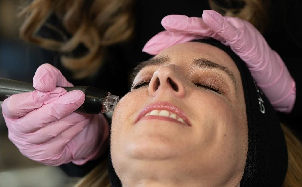 A woman receiving a cosmetic facial treatment with a small handheld device, lying down with eyes closed, wearing a black headband and pink gloves.