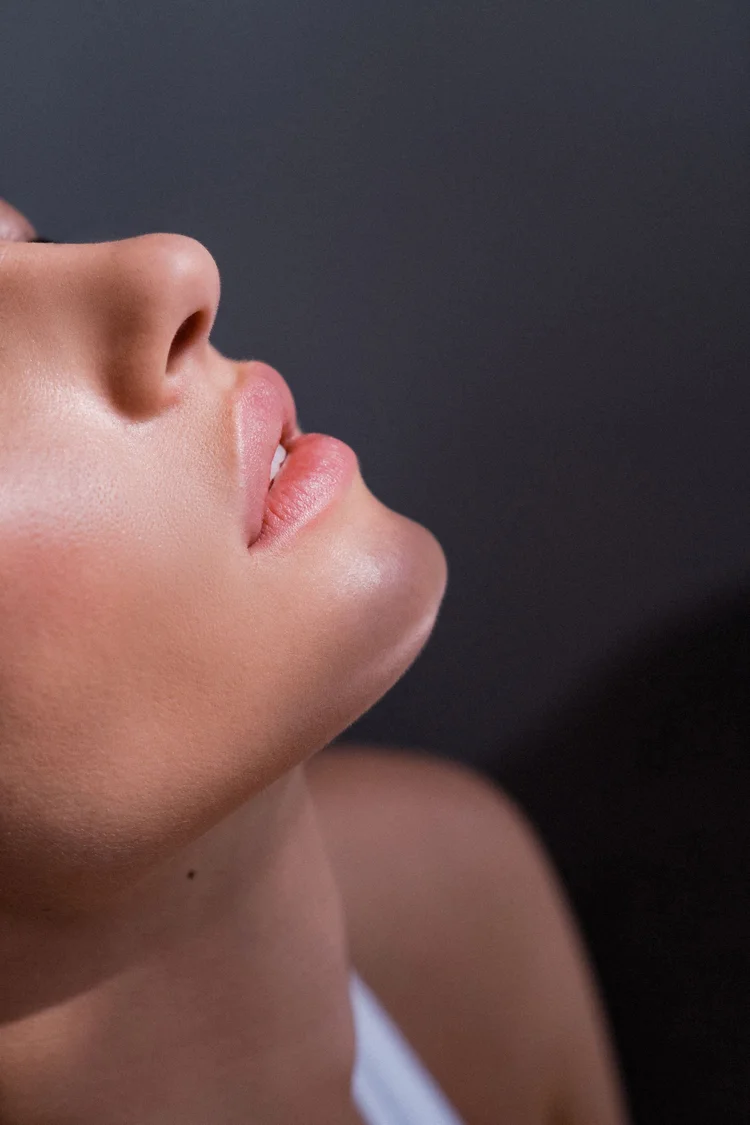 Dermal filler