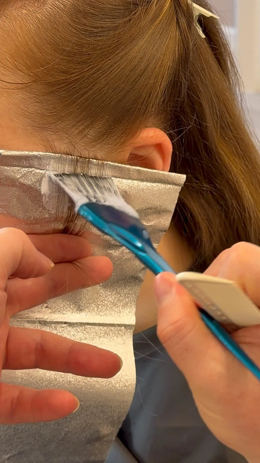 A person receiving a teeth cleaning at a dental office, with foam being applied to their teeth.