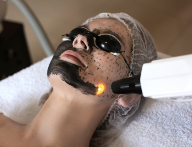 A woman undergoing a laser skin treatment, wearing protective goggles, with a technician using a laser device on her face, covering her with a black facial mask.