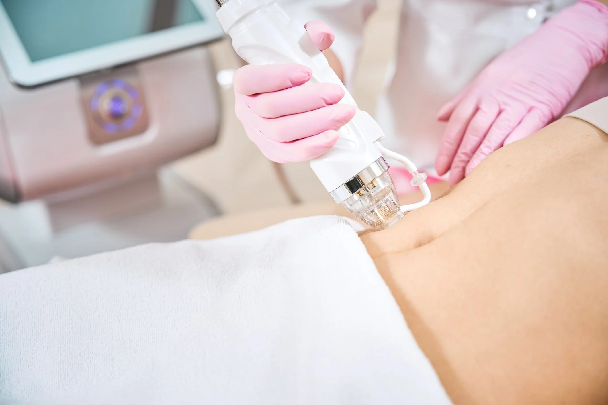 A skin clinician holding an rf microneedling device for skin tightening
