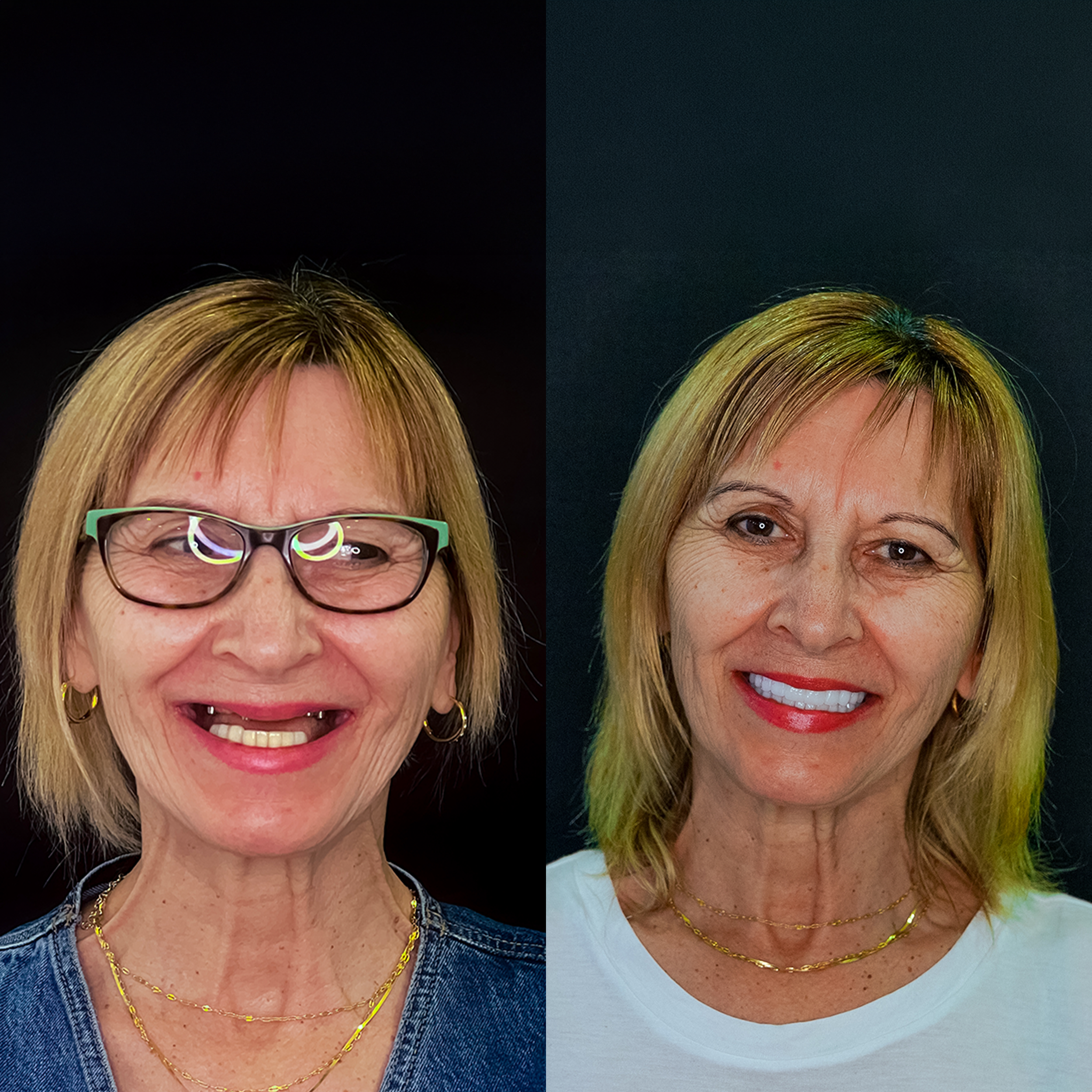 Comparison of two women with blonde hair and gold jewelry, one wearing glasses and a denim jacket, the other with a white top, both smiling against a black background.