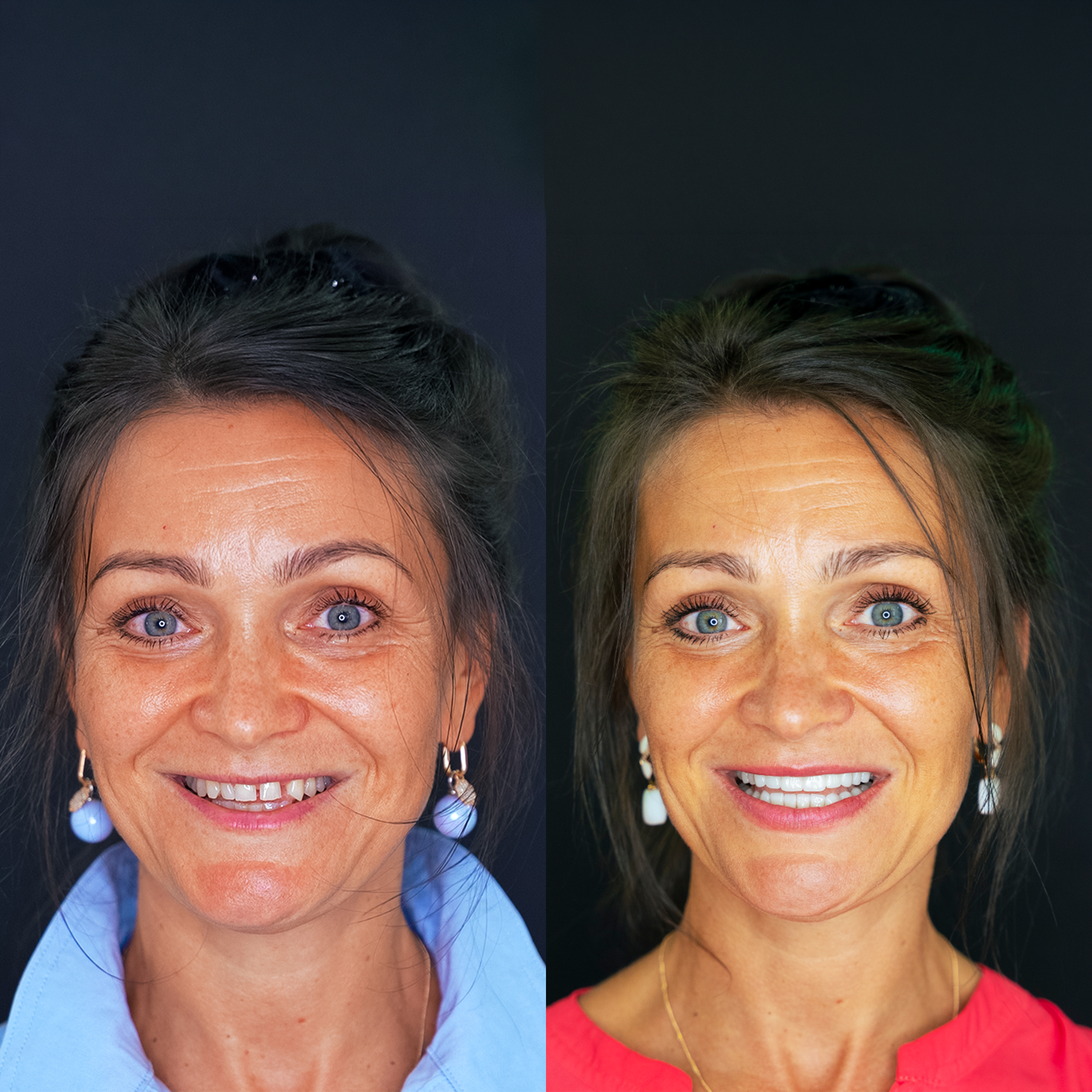 Close-up of two smiling women, one wearing a light blue top and the other a red top, showing their faces, eyes, hair, and earrings, against a dark background.