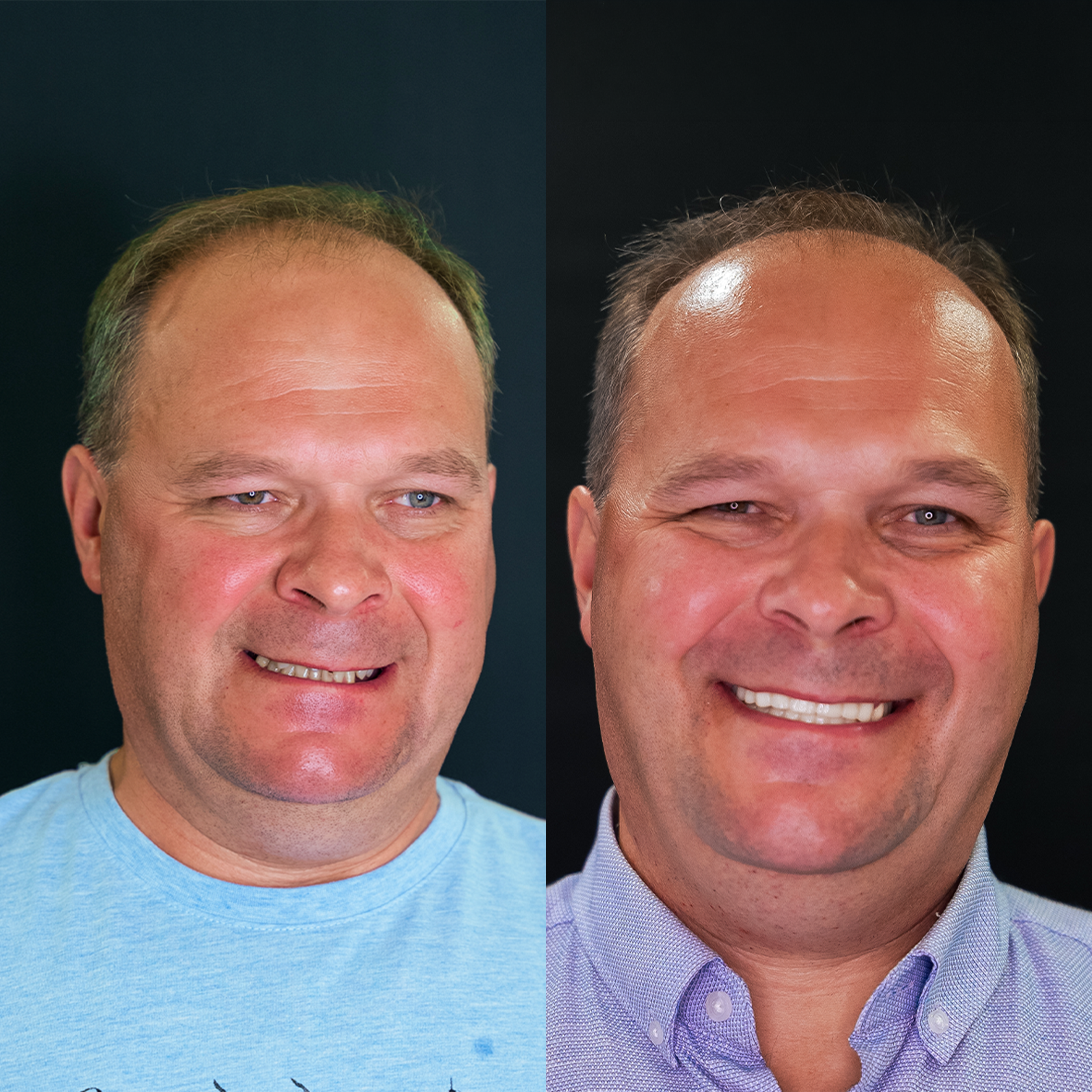 Close-up of two men's faces, showing the upper half from forehead to nose, smiling, with backgrounds that are dark. The man on the left has light skin, short light brown hair, and is wearing a light blue shirt. The man on the right has slightly darke