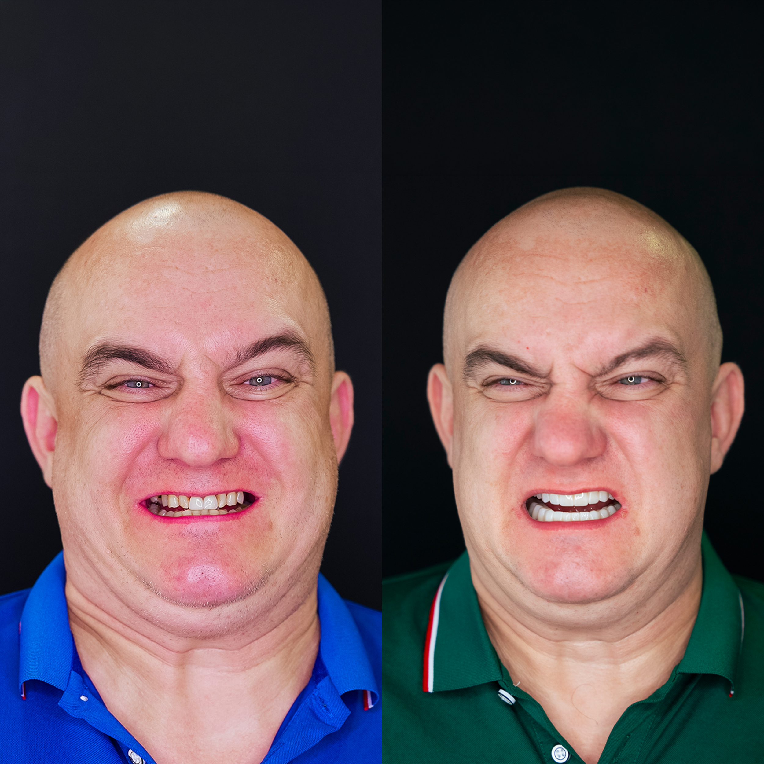 Close-up of two smiling men, one with a bald head and purple eyes wearing a blue collared shirt, the other with a bald head and squinting eyes wearing a green collared shirt.