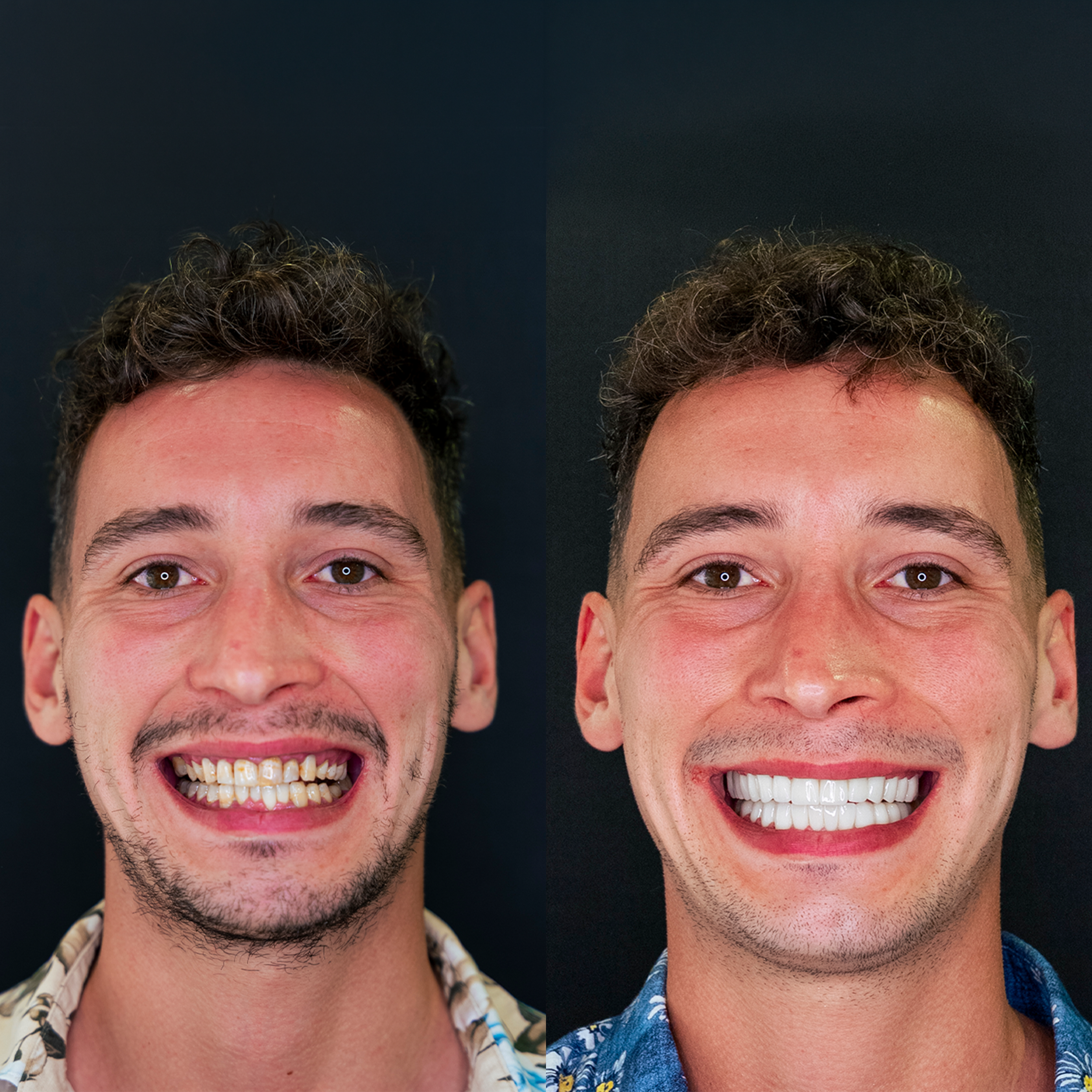 Close-up of two smiling men with brown hair, wearing patterned shirts, showing their faces from nose up, against a dark background.