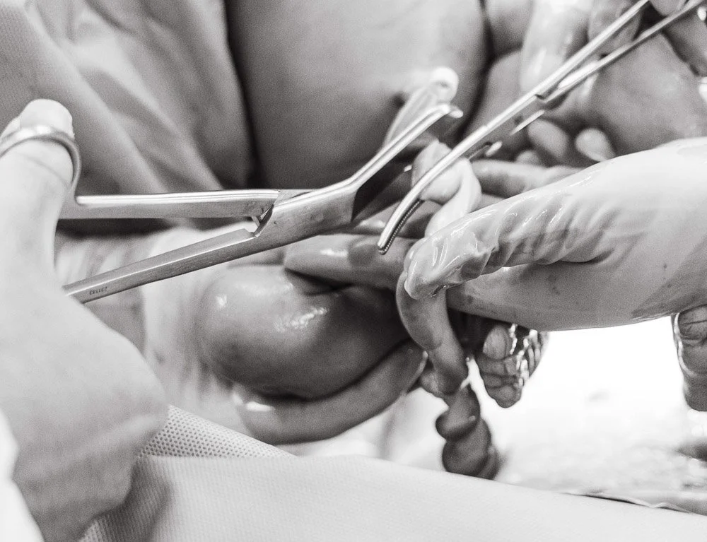 Surgeons wearing gloves perform a surgical procedure using forceps and scissors. c-section birth photographer Georgetown Texas