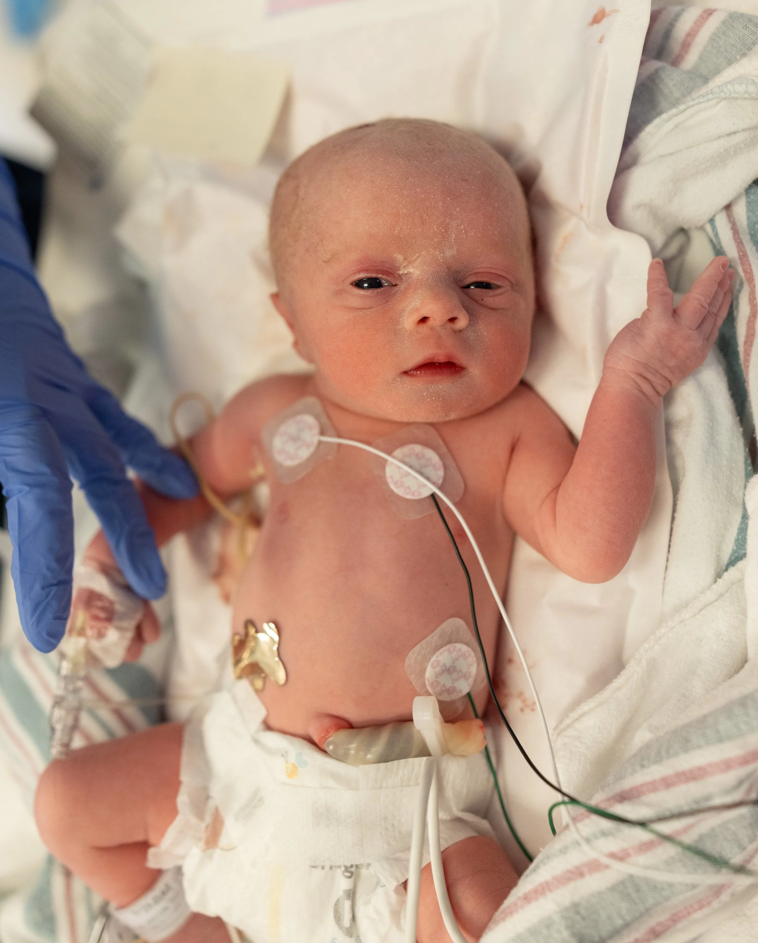 Newborn baby with medical equipment attached, lying in a hospital bed, raising one hand. twin birth photographer in Austin Texas