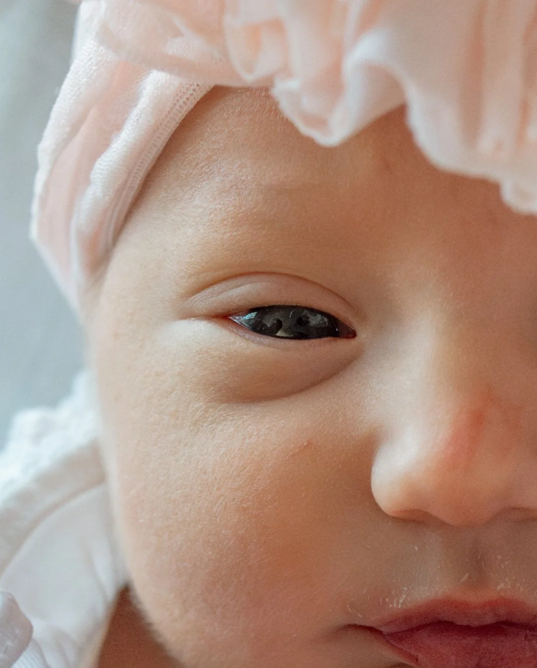 Close-up of a baby's face, focusing on one eye and cheek, wearing a light pink head covering with ruffles.