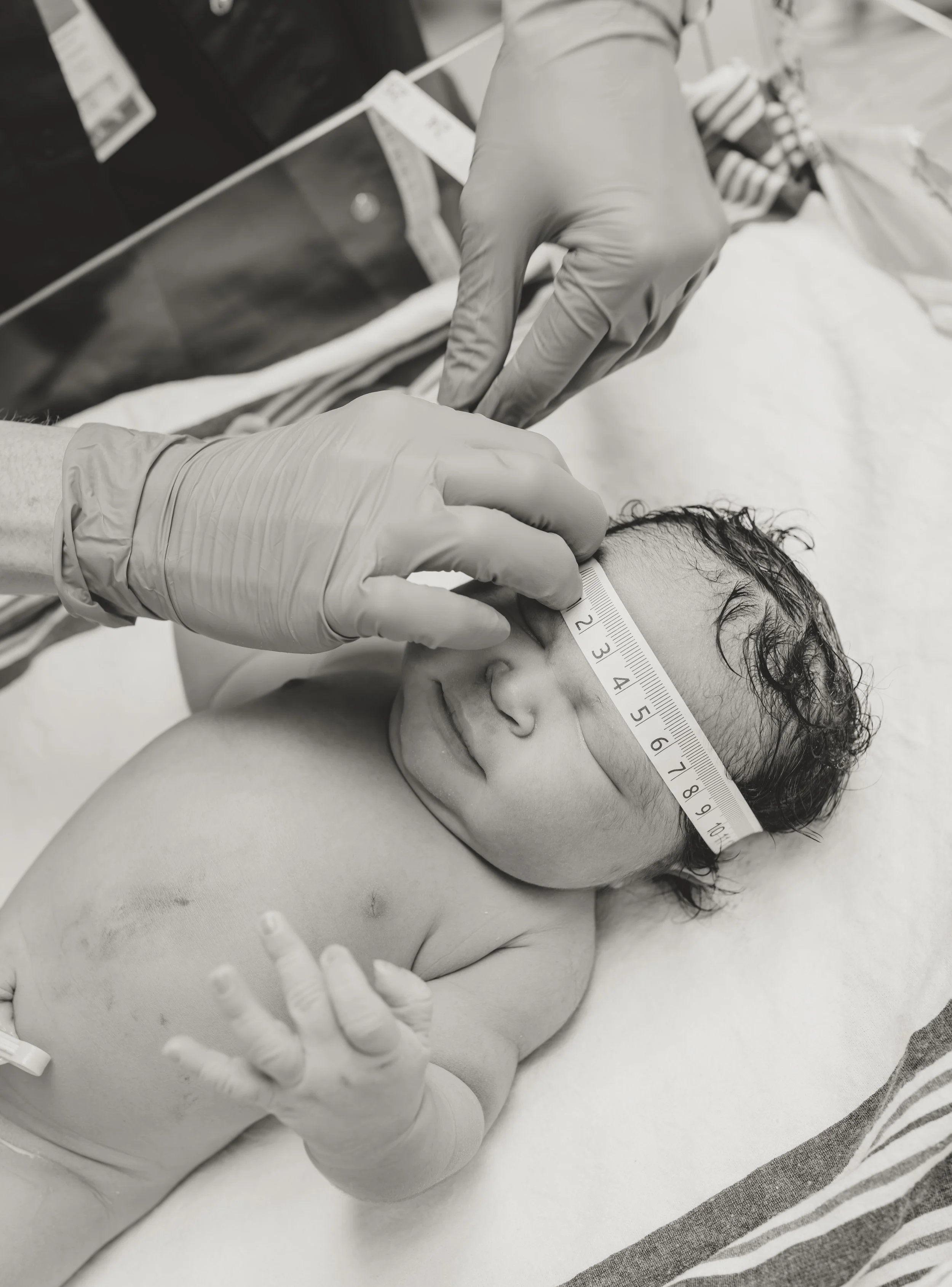 A newborn baby lying on a hospital bed with a measuring ruler across face, a healthcare worker in gloves gently touching the baby's head, other medical equipment and supplies nearby.