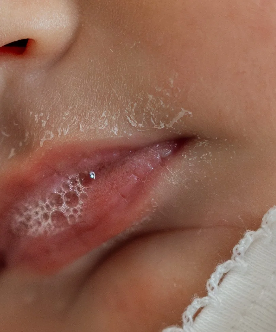 Close-up of a person's lips and surrounding skin with some peeling and bubbles, possibly soap or foam.