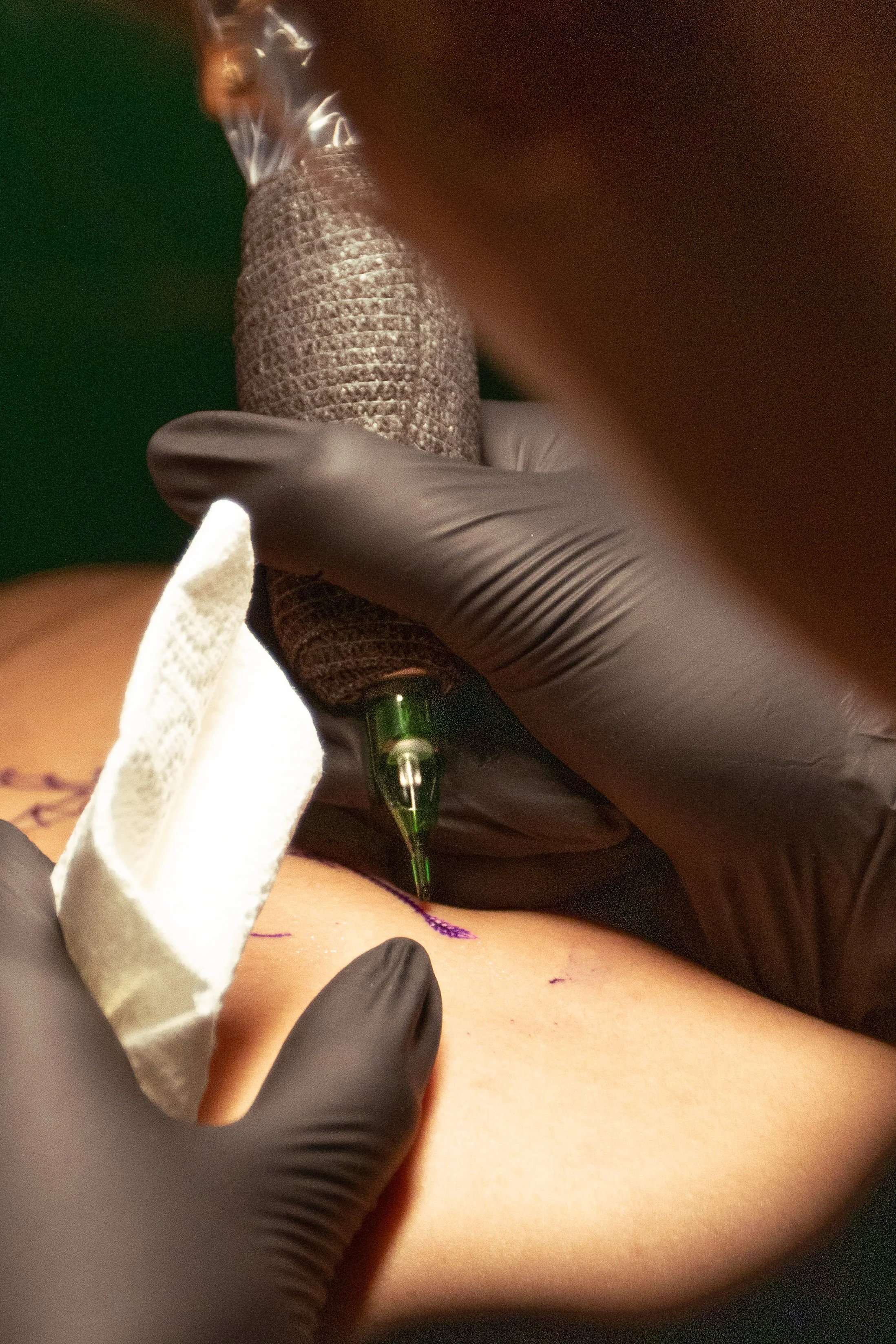 Close-up of a hand wearing black medical gloves administering an injection into a person's arm, with the needle and a drop of liquid visible, and a purple mark on the skin.
