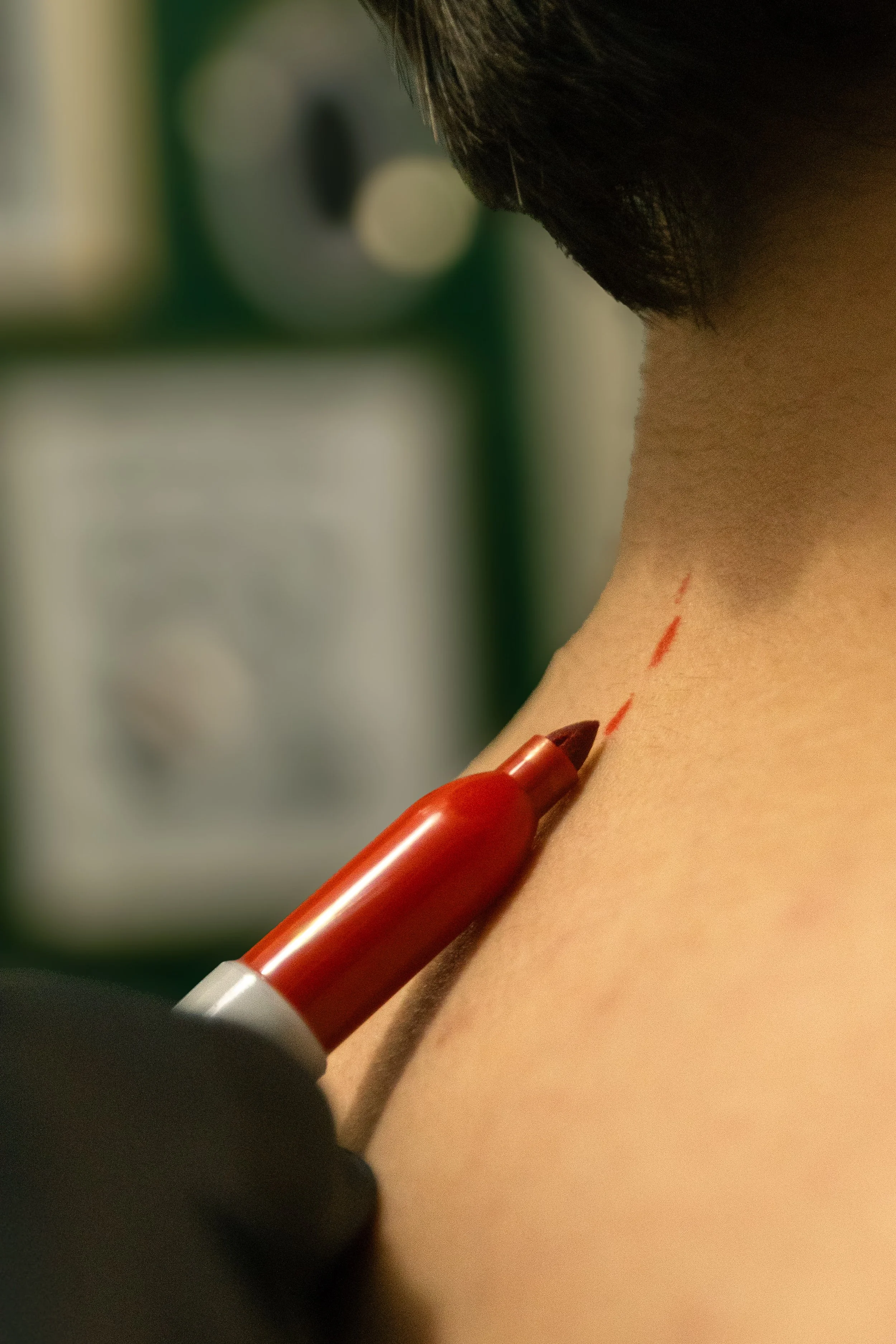Close-up of a person with a neck injury marked with red dotted lines, a hand holding a marker, and a blurred background.