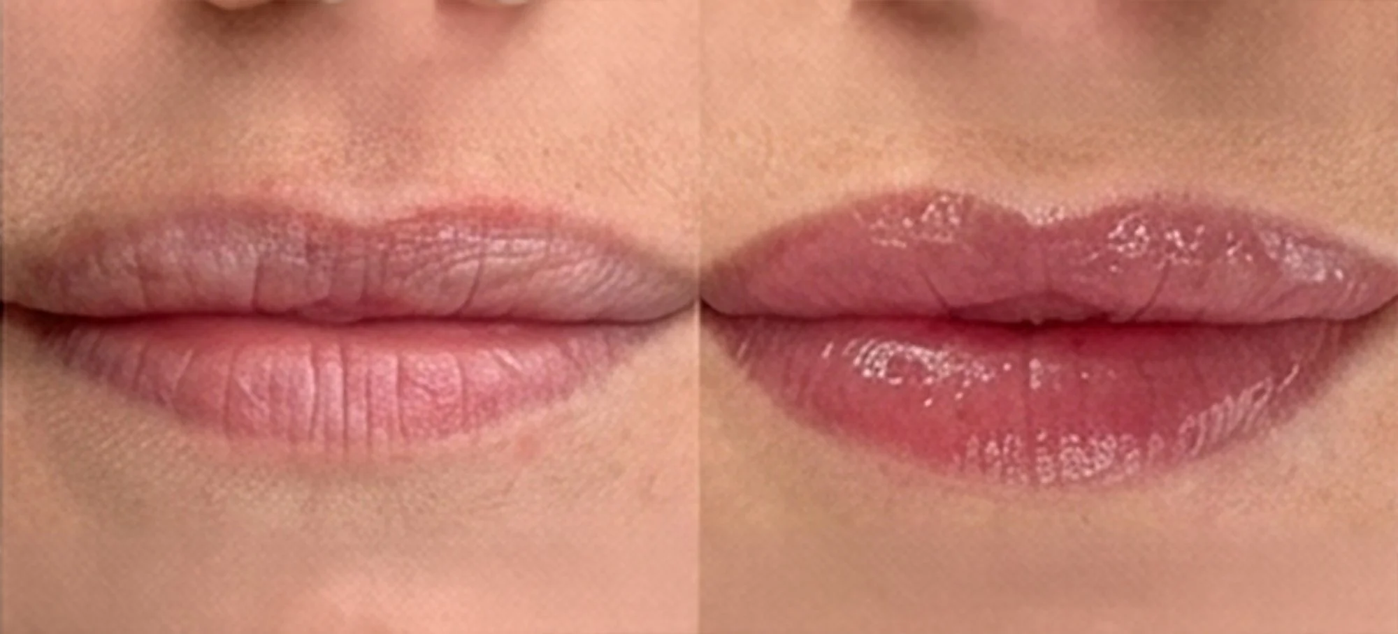 Lip-Blush før/etter
