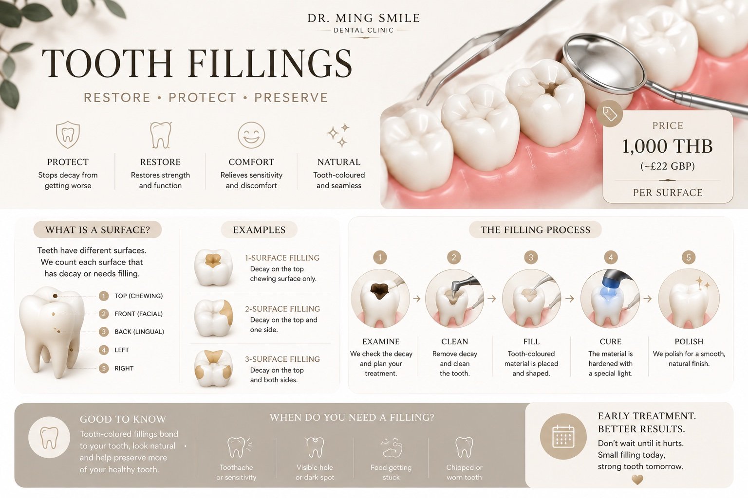 An infographic from Dr. Ming Smile Dental Clinic explaining the tooth filling process. It includes details about the benefits of fillings like protection, restoration, comfort, and natural look. The infographic illustrates what a surface is, provides examples of types of fillings, and shows the five steps of the filling process: examine, clean, fill, cure, and polish. It also highlights when fillings are needed and mentions the importance of early treatment for better results. The price of a filling is listed as 1,000 THB (~22 GBP) per surface.