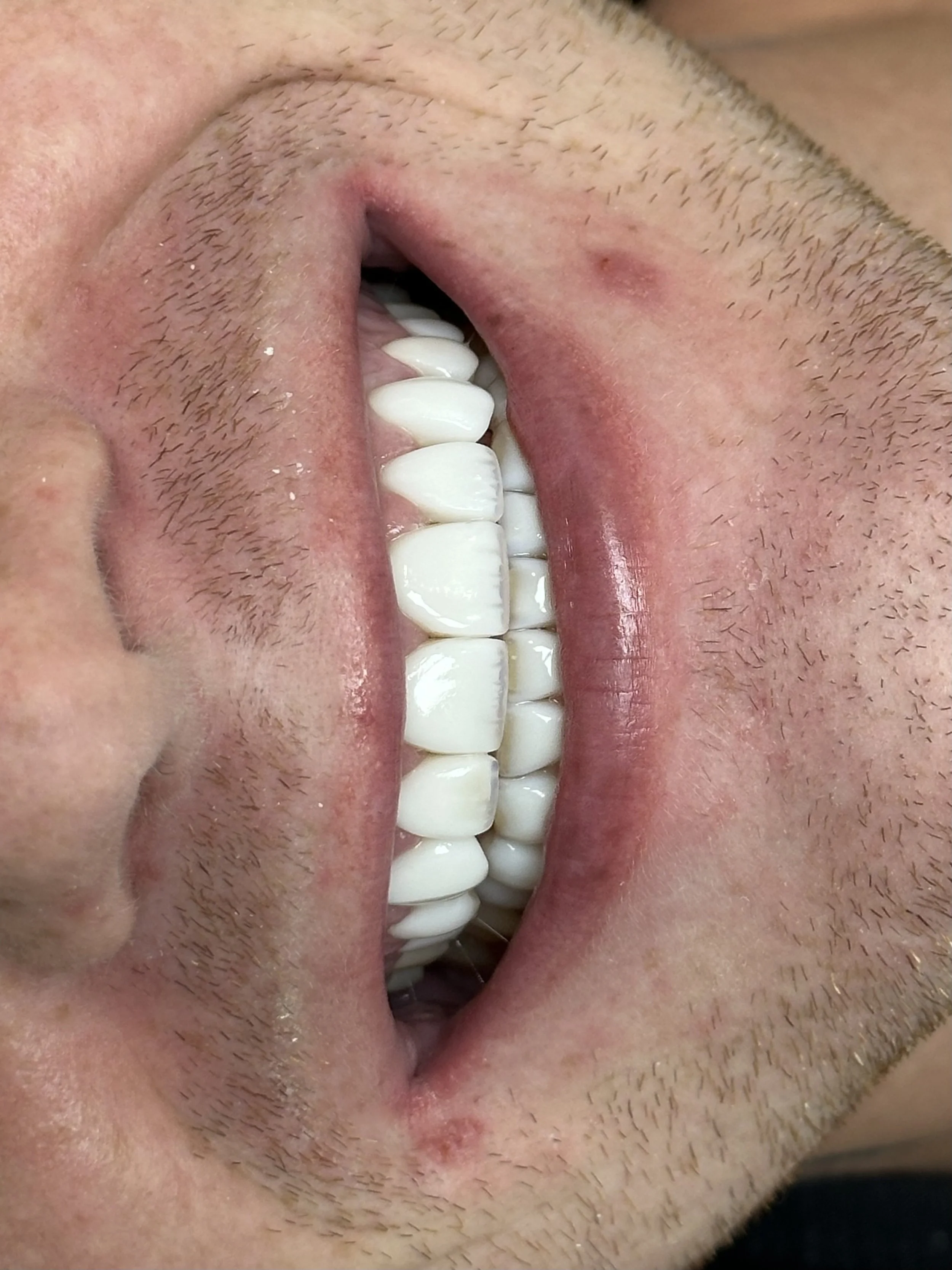 Close-up of a person's open mouth showing teeth and tongue, with facial hair visible around the lips.