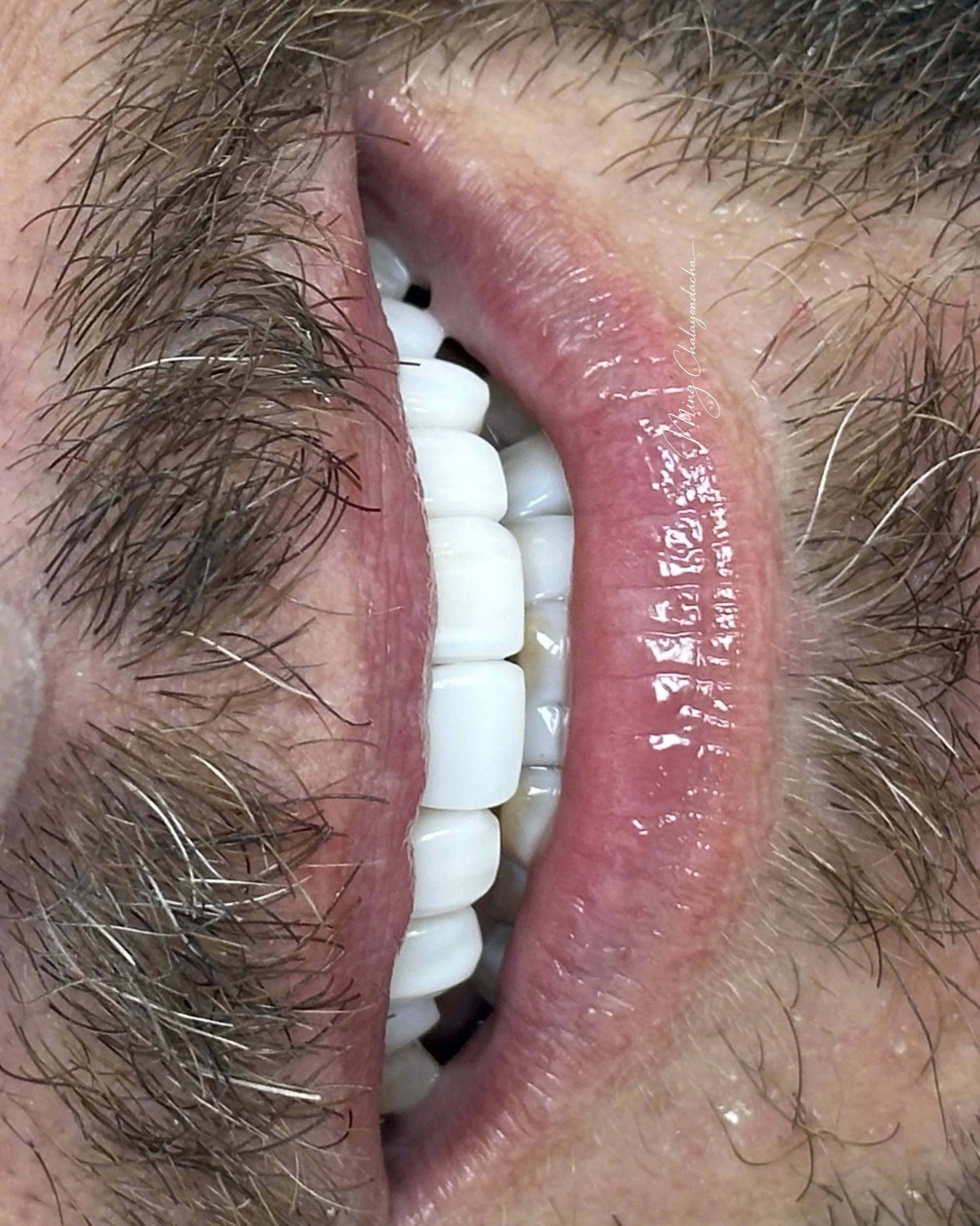 Close-up of a person's mouth with visible teeth, tongue, lips, and facial hair.