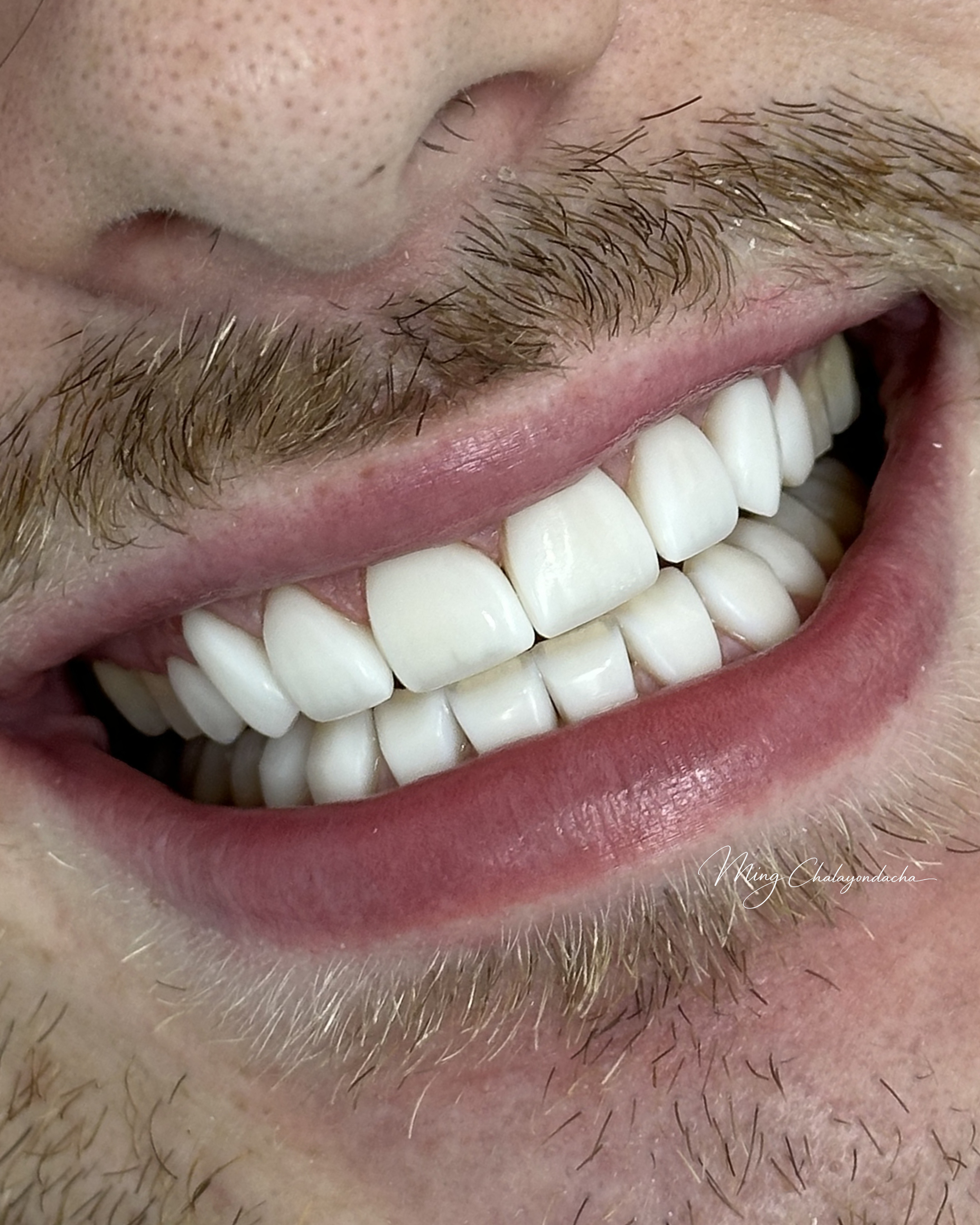 Dr.Ming Portrait size  - 12.png