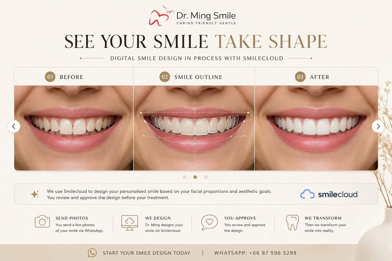 A promotional image for Dr. Ming Smile showcasing a three-step process for digital smile design: before, smile outline, and after. It displays a woman’s smile before and after dental treatment, with a smile outline in the middle. Text describes using Smilecloud for personalized smile design, including sending photos, reviewing, approving, and transformation process, with contact information for WhatsApp.
