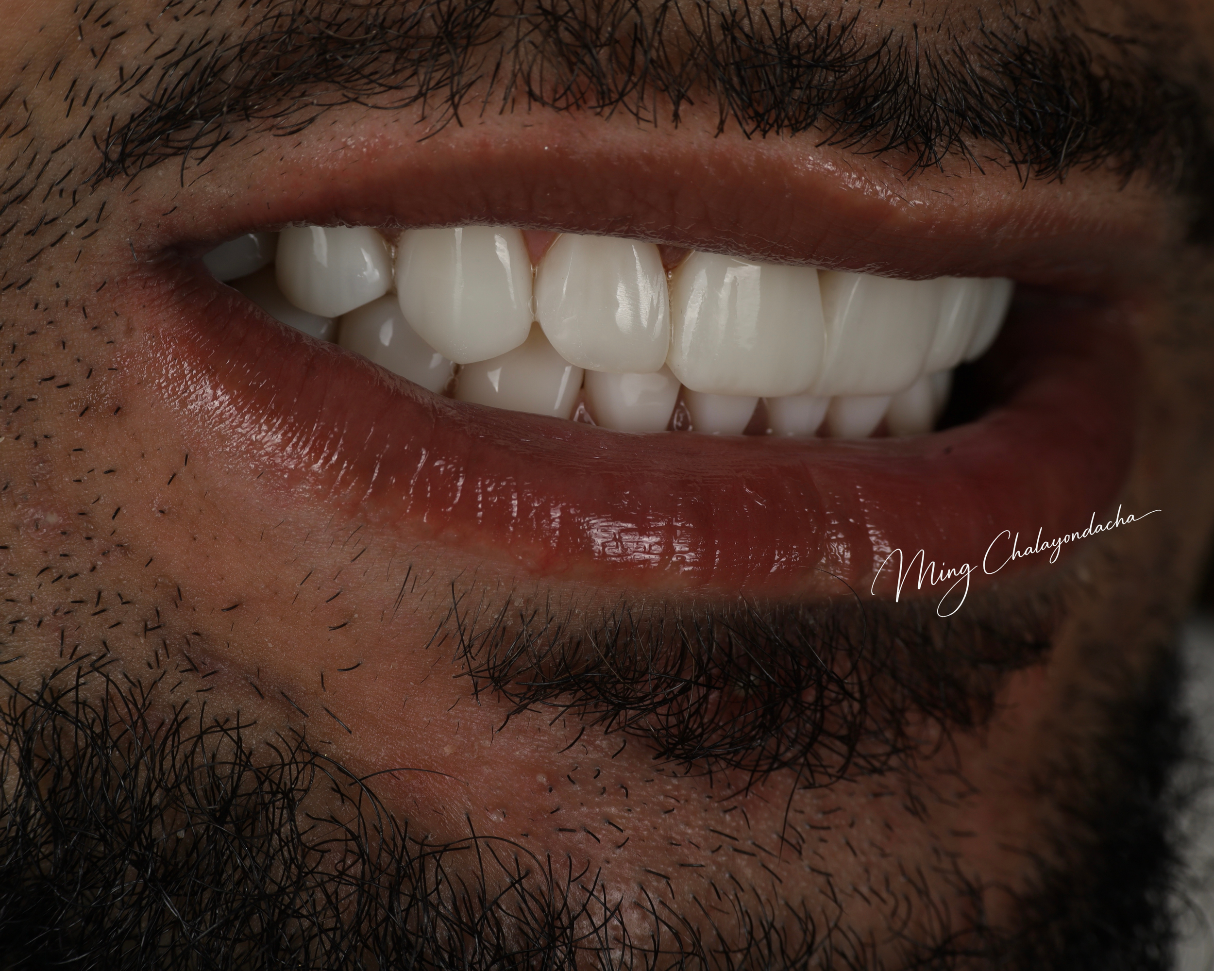 9.png