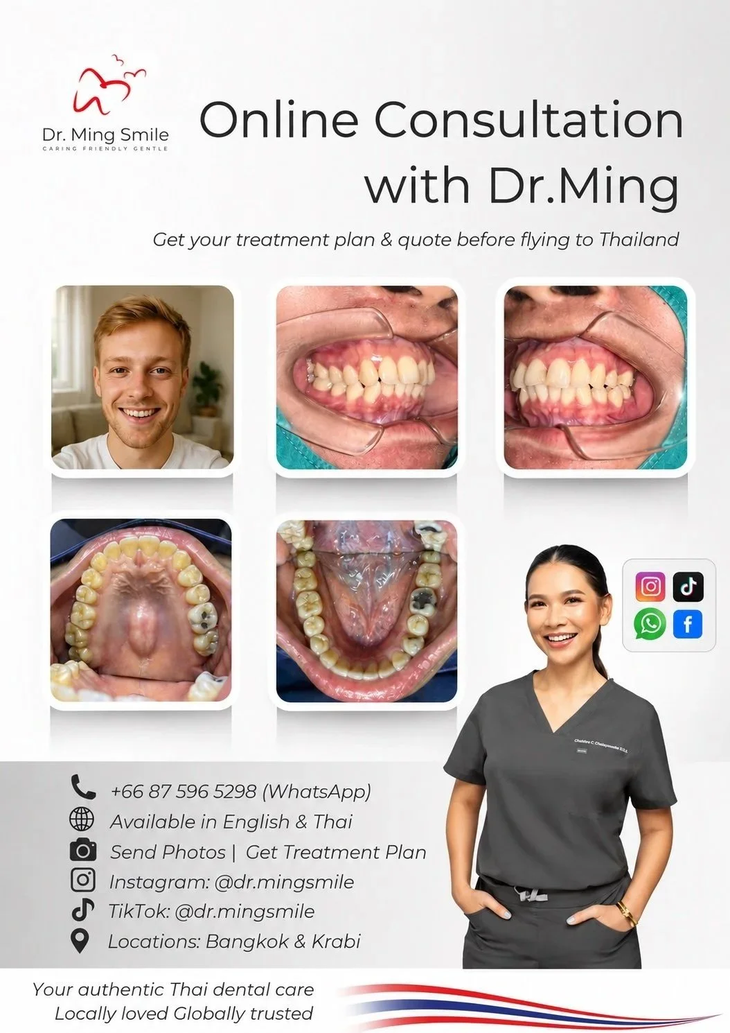 Poster advertising online dental consultation with Dr. Ming Smile, including photos of dental patients' teeth before and after treatment, a smiling female dentist in scrubs, and contact information with icons for WhatsApp, Instagram, TikTok, Facebook, and locations in Bangkok and Krabi.