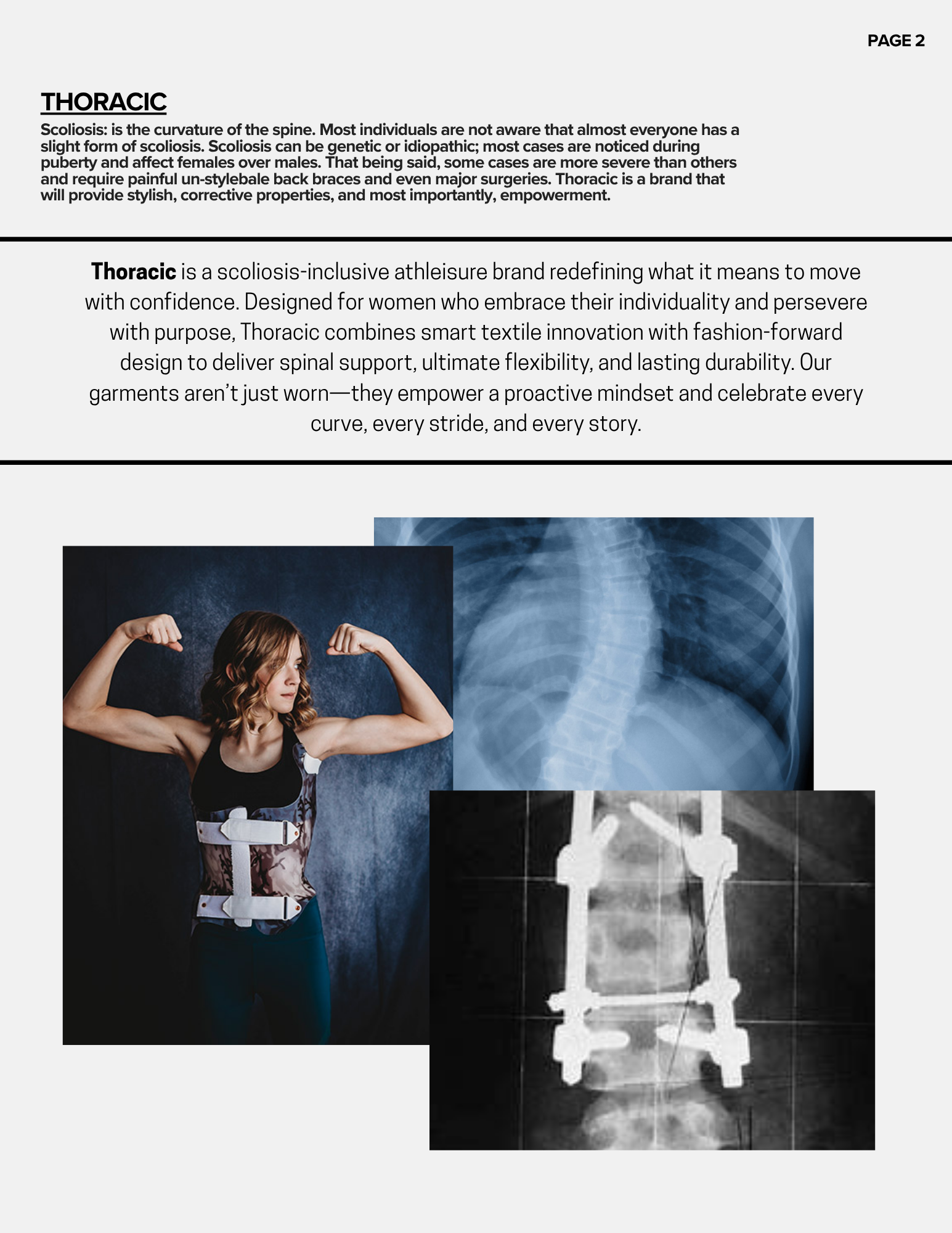 A woman with curly hair flexing her bicep muscles, wearing a back brace and sportswear, standing against a textured dark background. There are several X-ray images of a chest and a fractured object on the page.
