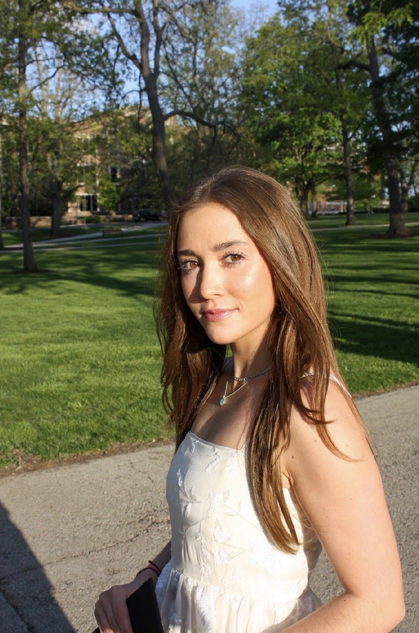 Young woman with long brown hair wearing a white dress and jewelry, standing outdoors in a park with green grass and trees, on a sunny day.