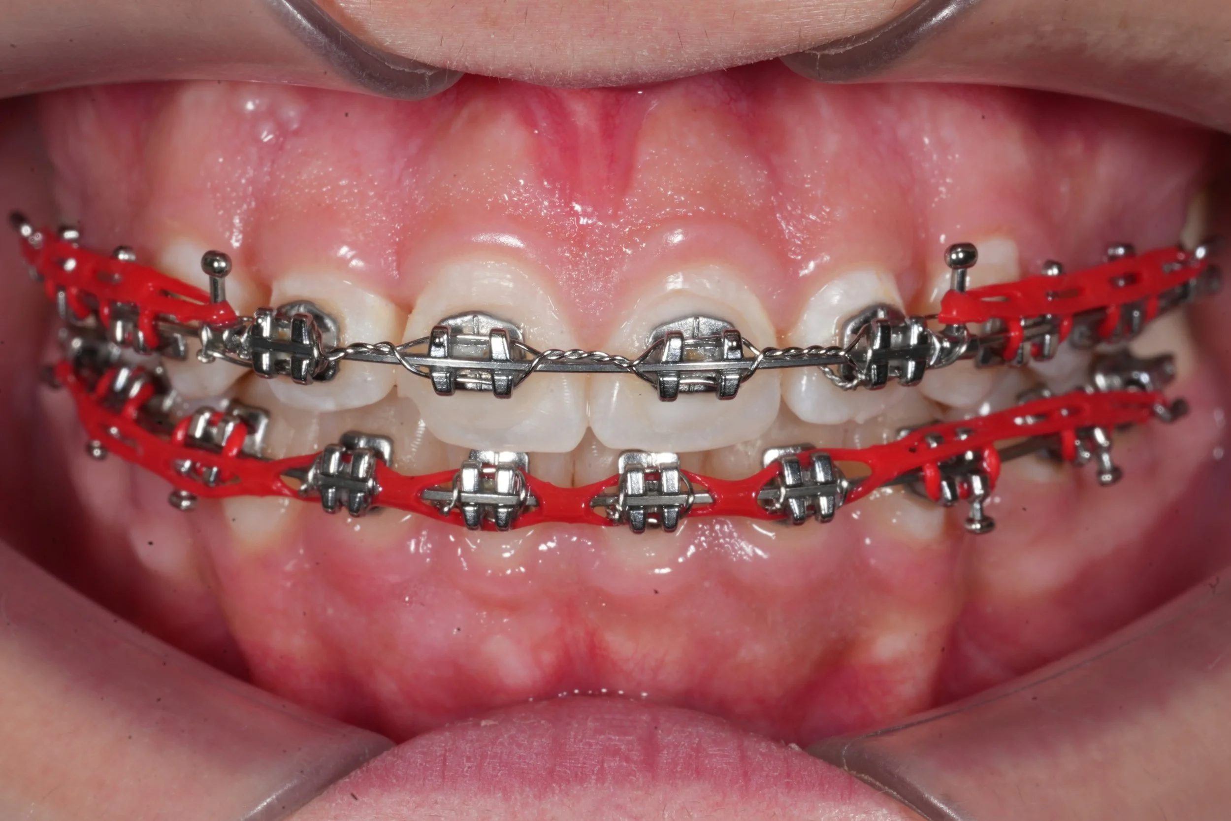 Orthodontics