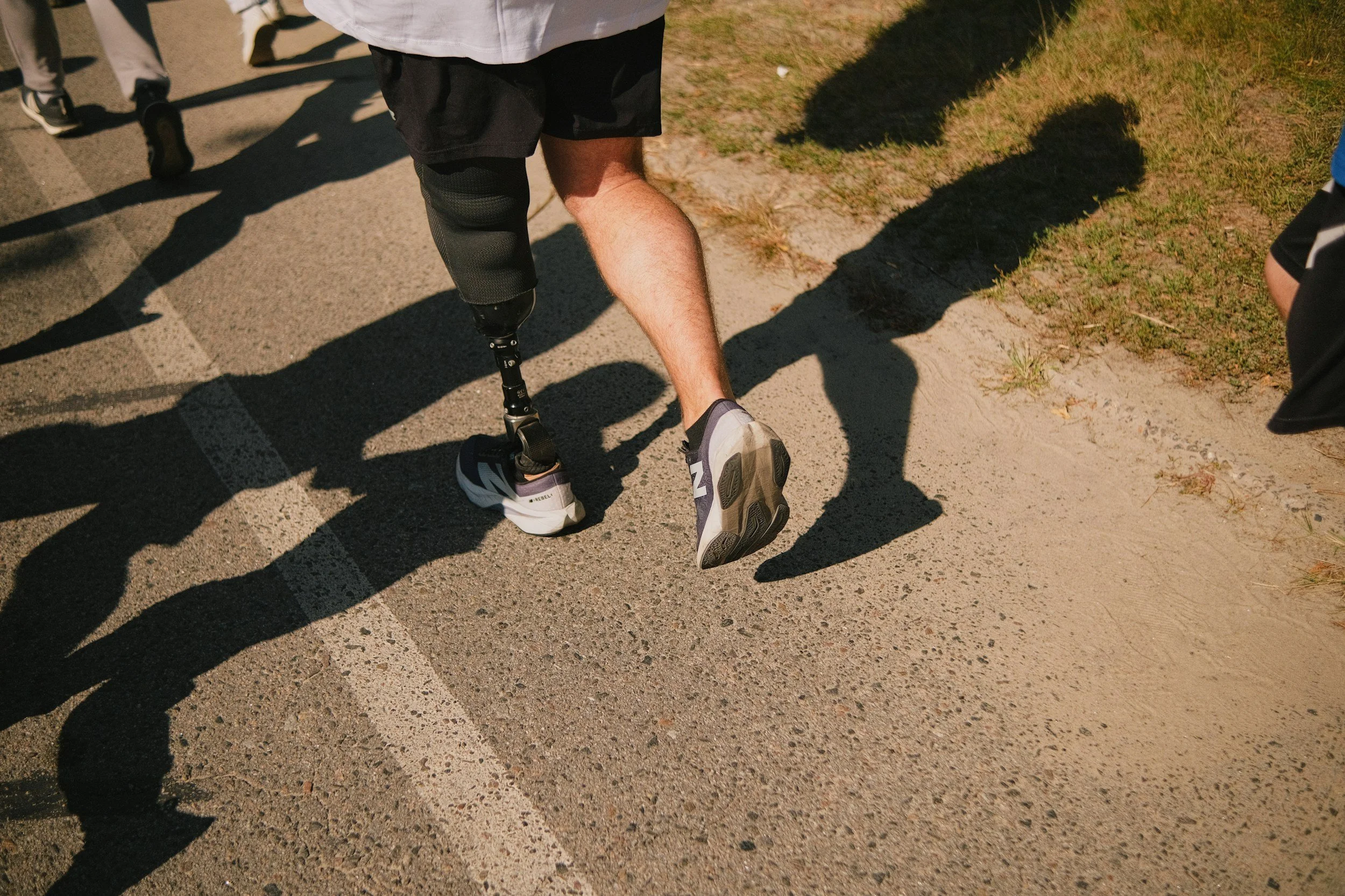 Prosthetic interventions