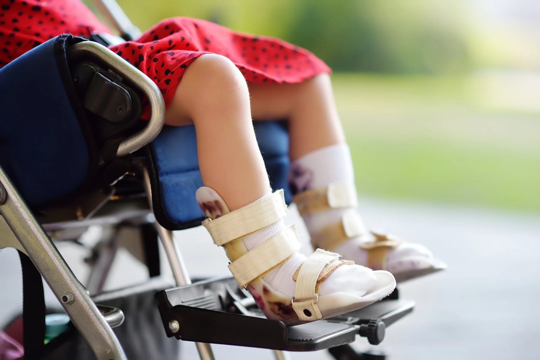Close-up of a child's legs and feet in a wheelchair, wearing beige shoes and white socks with beige straps, and a red dress with black spots. The background is blurred greenery.