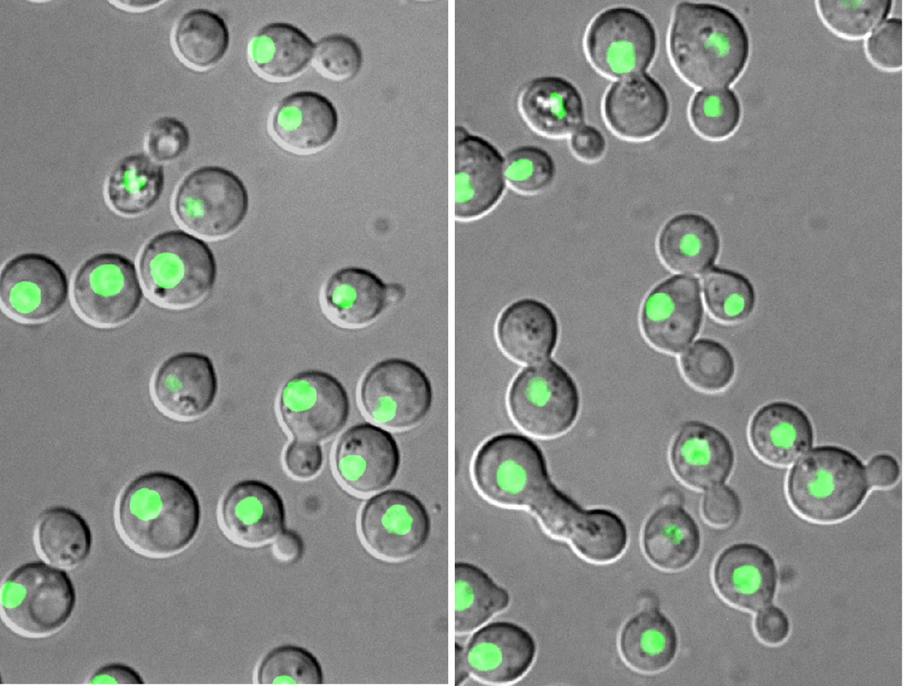 C. neoformans cells expressing GFP-tagged histone H4 as the nuclear marker. Right, wild-type cells; left, calcineurin mutant cells.