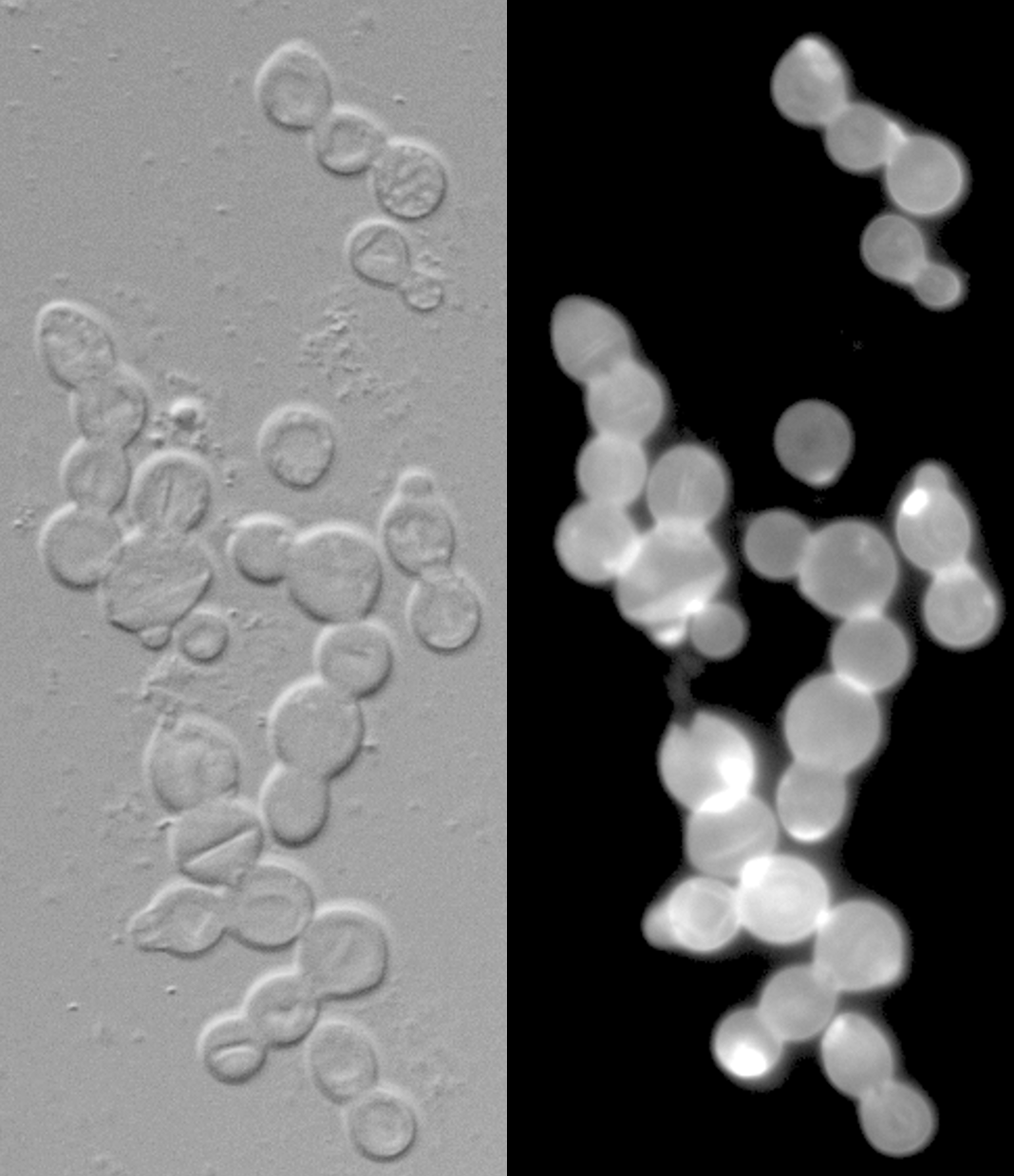 C. deneoformans cells exhibiting cytokinesis defect upon calcineurin inhibition; phase contrast on the left and cells stained for chitin are shown on the right.