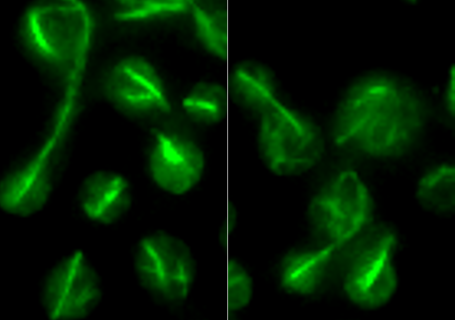 Microtubule localization in the wild-type (left) and calcineurin mutant (right) strains of C. neoformans.